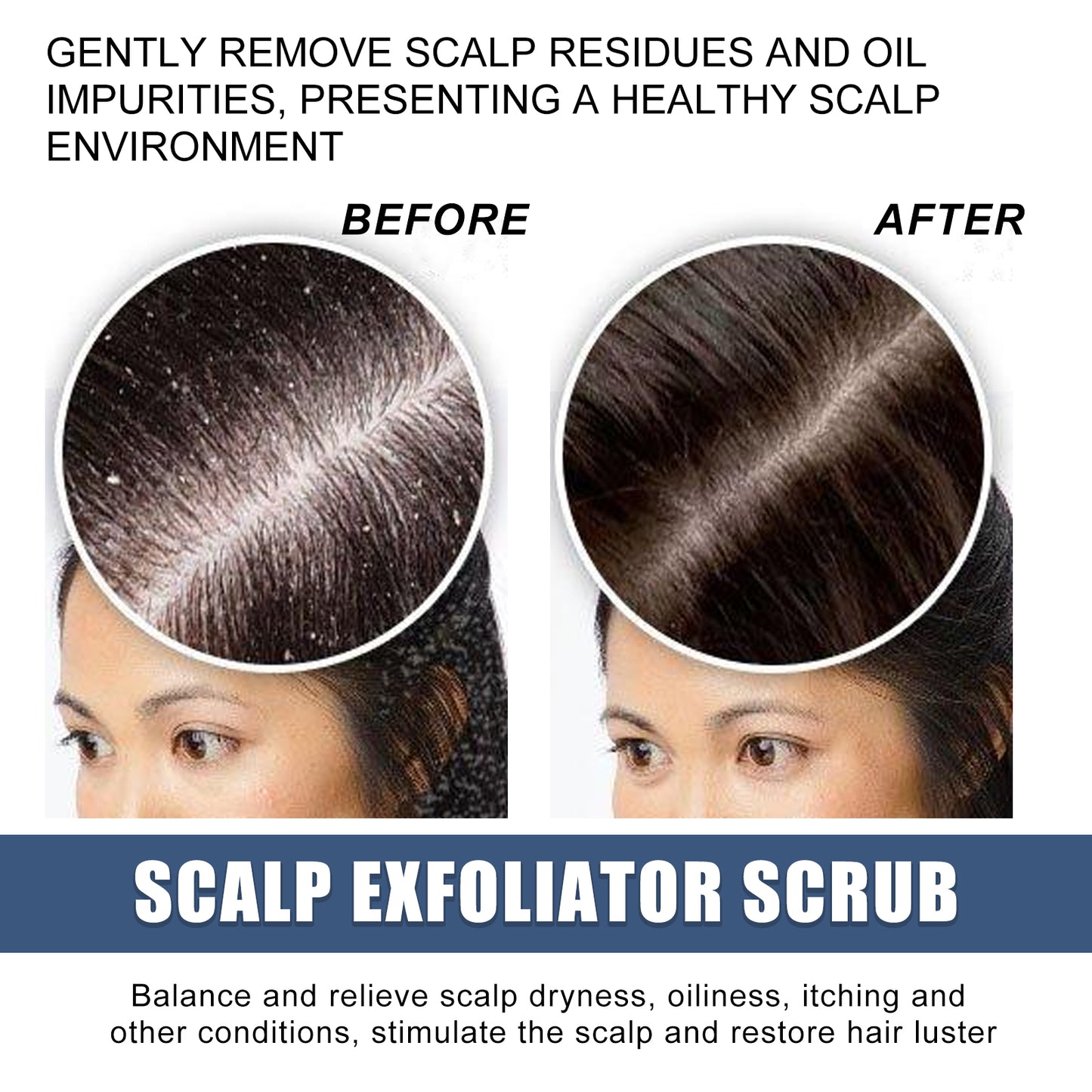 Scalp Exfoliating Scrub Moisturizes Dry Hair And Scalp Cleansing Treatment Refreshing Scrub Health Eprolo https://www.cyberehub.com