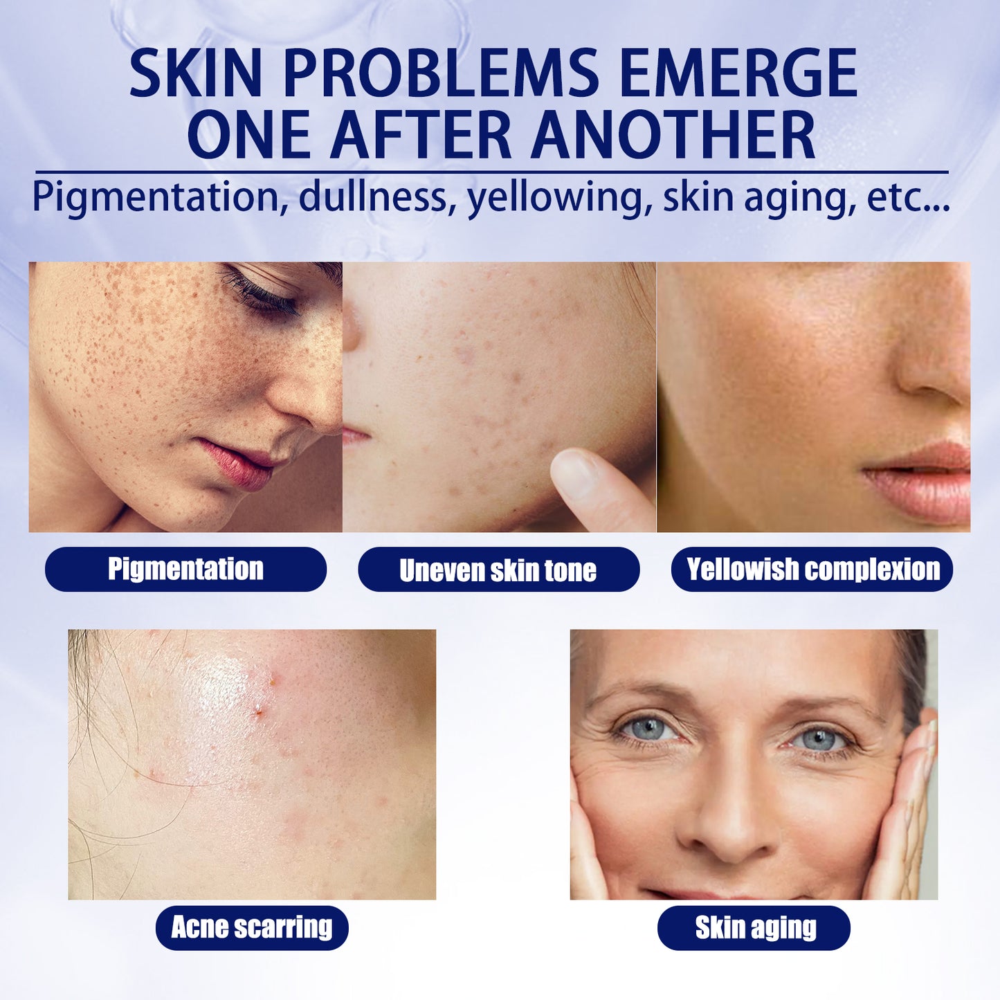 Anti-aging Vitamin C Facial Essence, Reduces Spots Acne Fine Lines, Moisturizes Facial Essence Health Eprolo https://www.cyberehub.com
