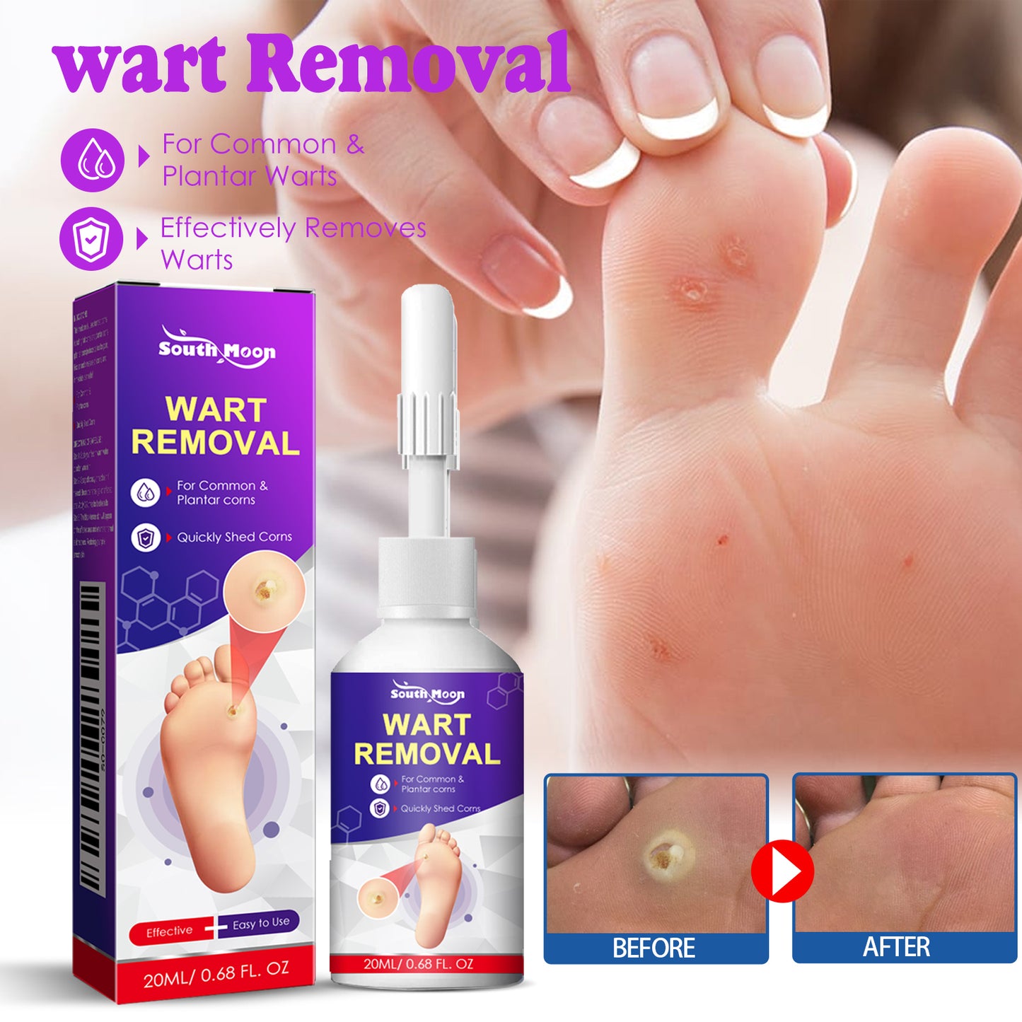 Remove Chicken Eye Lotion Extra Clear Remove Corns Skin Care Chicken Calluses Foot Pad Gram Warts Health Eprolo https://www.cyberehub.com