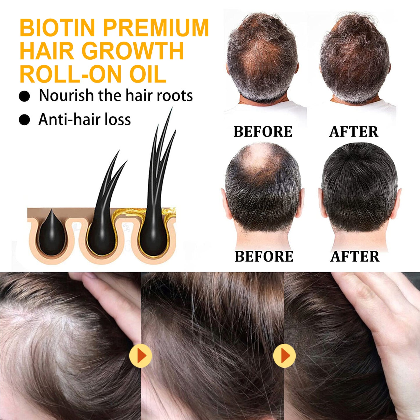 Biotin Hair Care Ball Gentle Ingredients Nourish And Moisturize Hair, Smooth And Glossy Hair Care Ball Health & Beauty Health Eprolo https://www.cyberehub.com