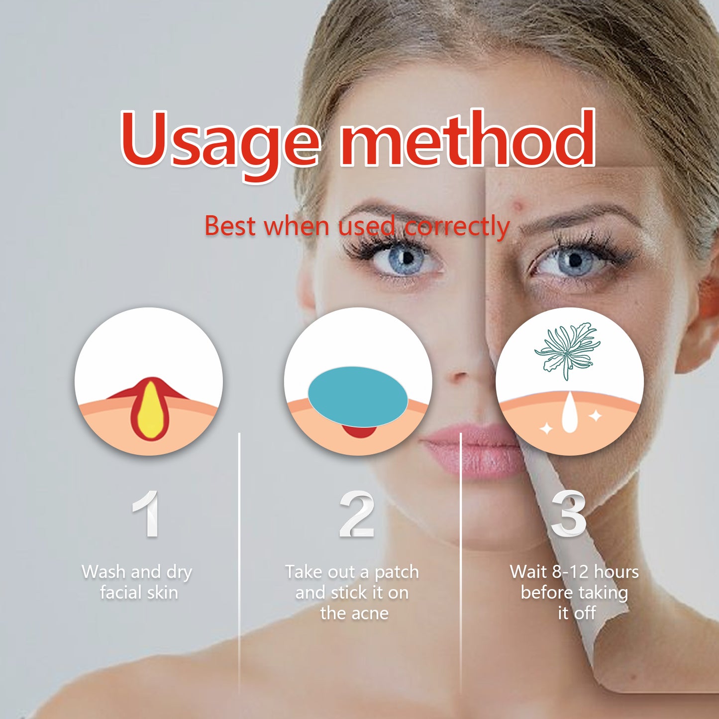 Hydrocolloid Acne Patch, Mild Non-Irritant Lightening Acne Pimples Closed Mouth Improve Acne Muscle Hydrocolloidal Acne Patch Health Eprolo https://www.cyberehub.com