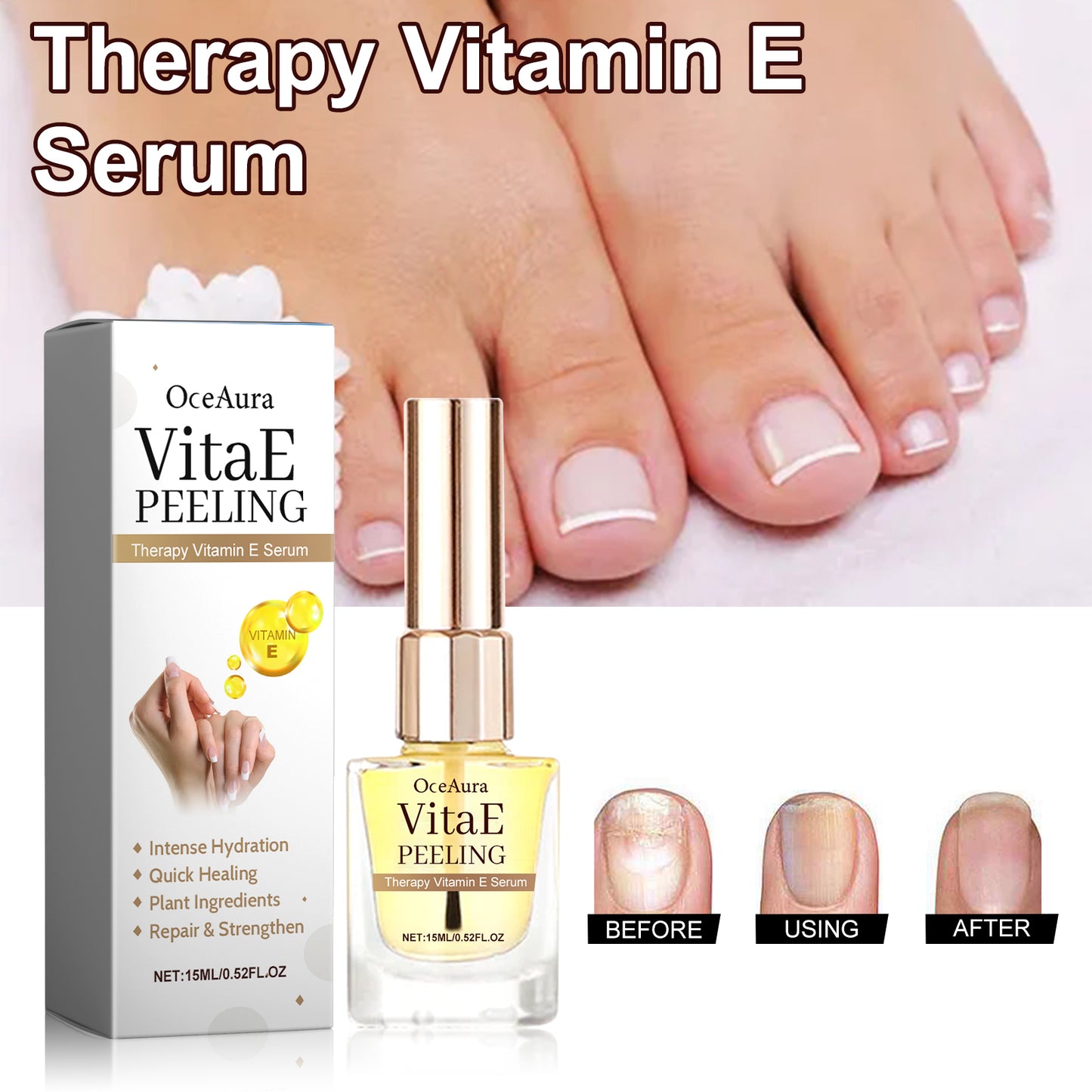 Therapy Vitamin E Serum, Hand And Foot Nail Repair Bright Nail Grey Nail Soft Nail Embedded Nail Care Essence Health Eprolo https://www.cyberehub.com