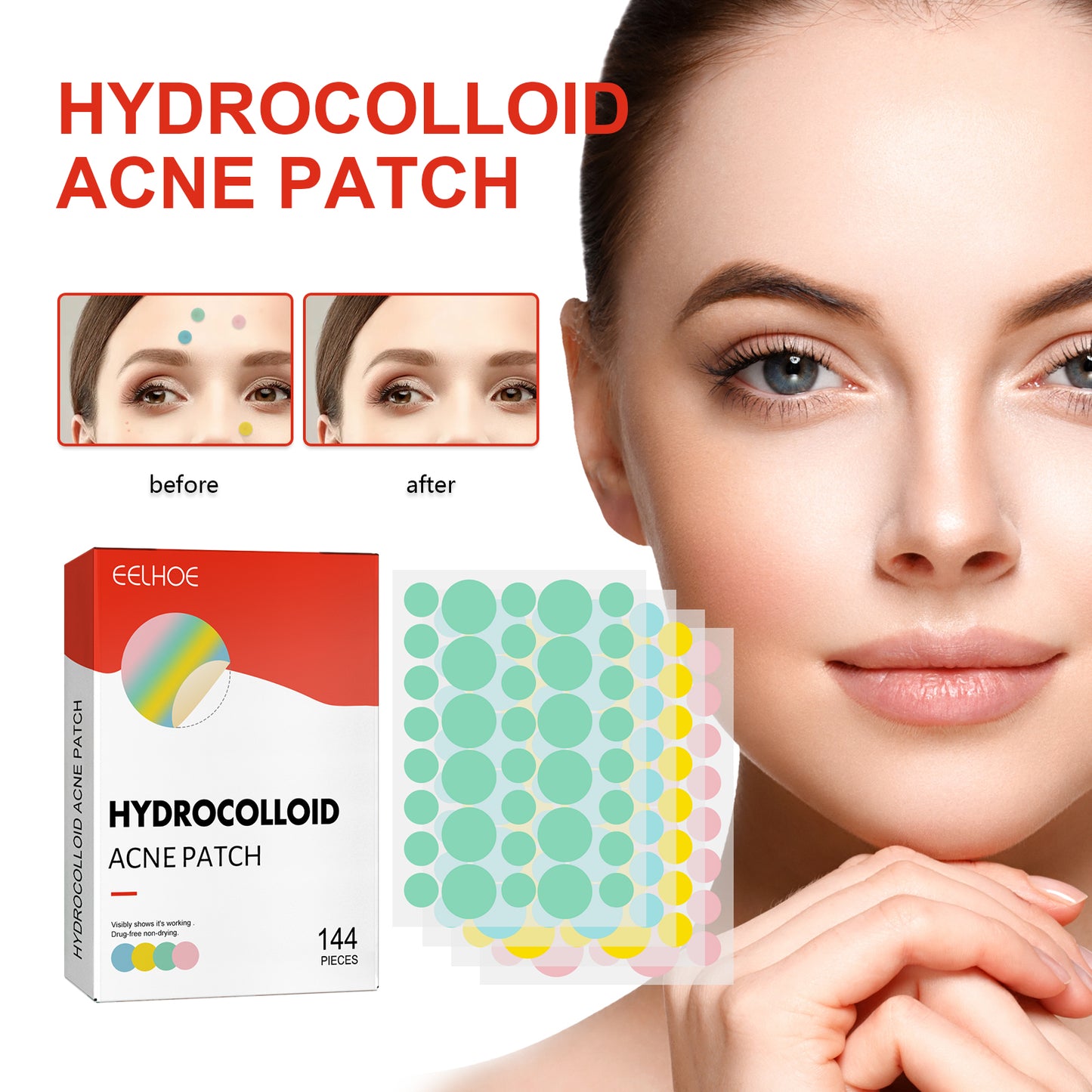 Hydrocolloid Acne Patch, Mild Non-Irritant Lightening Acne Pimples Closed Mouth Improve Acne Muscle Hydrocolloidal Acne Patch Health Eprolo https://www.cyberehub.com