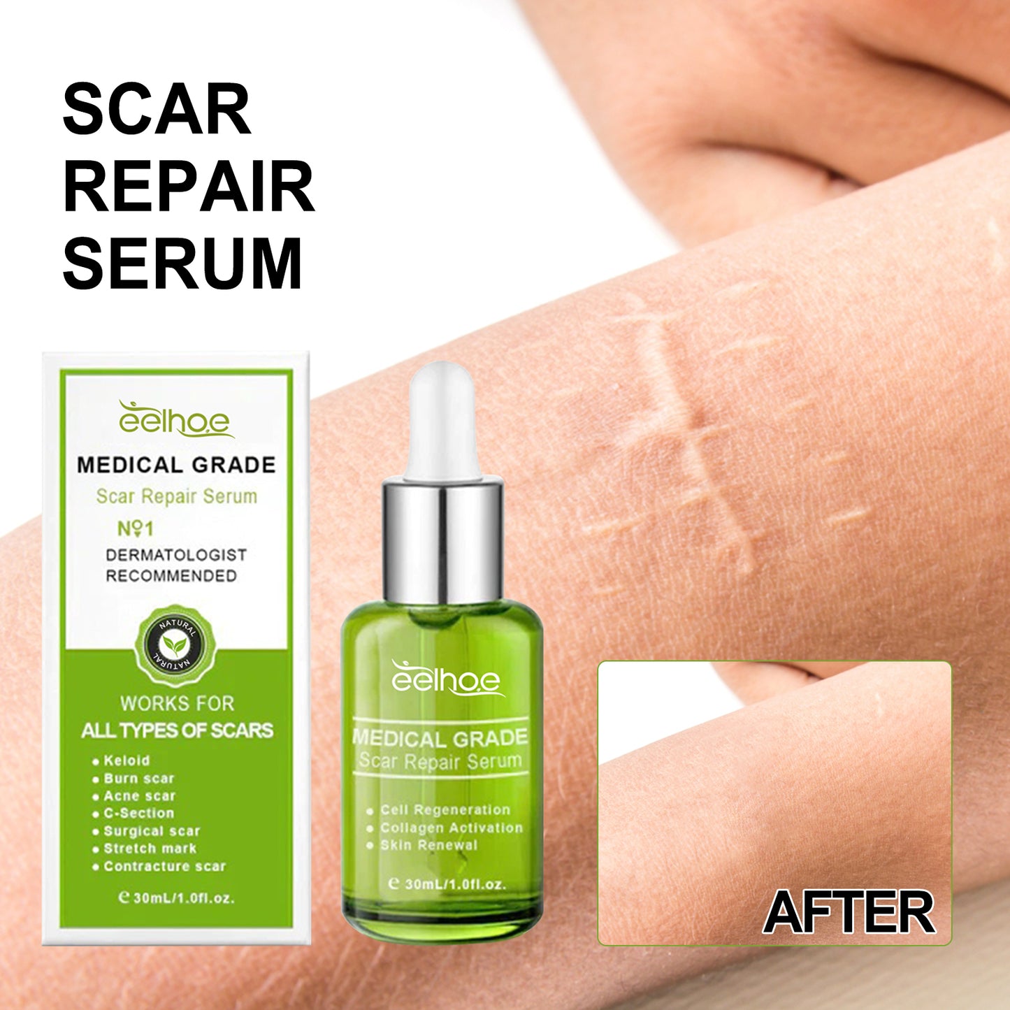 Scar Repair Serum Reduces Scar Acne Mark Pregnancy Surgery Scar Repair Smooth Skin Care Health Eprolo https://www.cyberehub.com