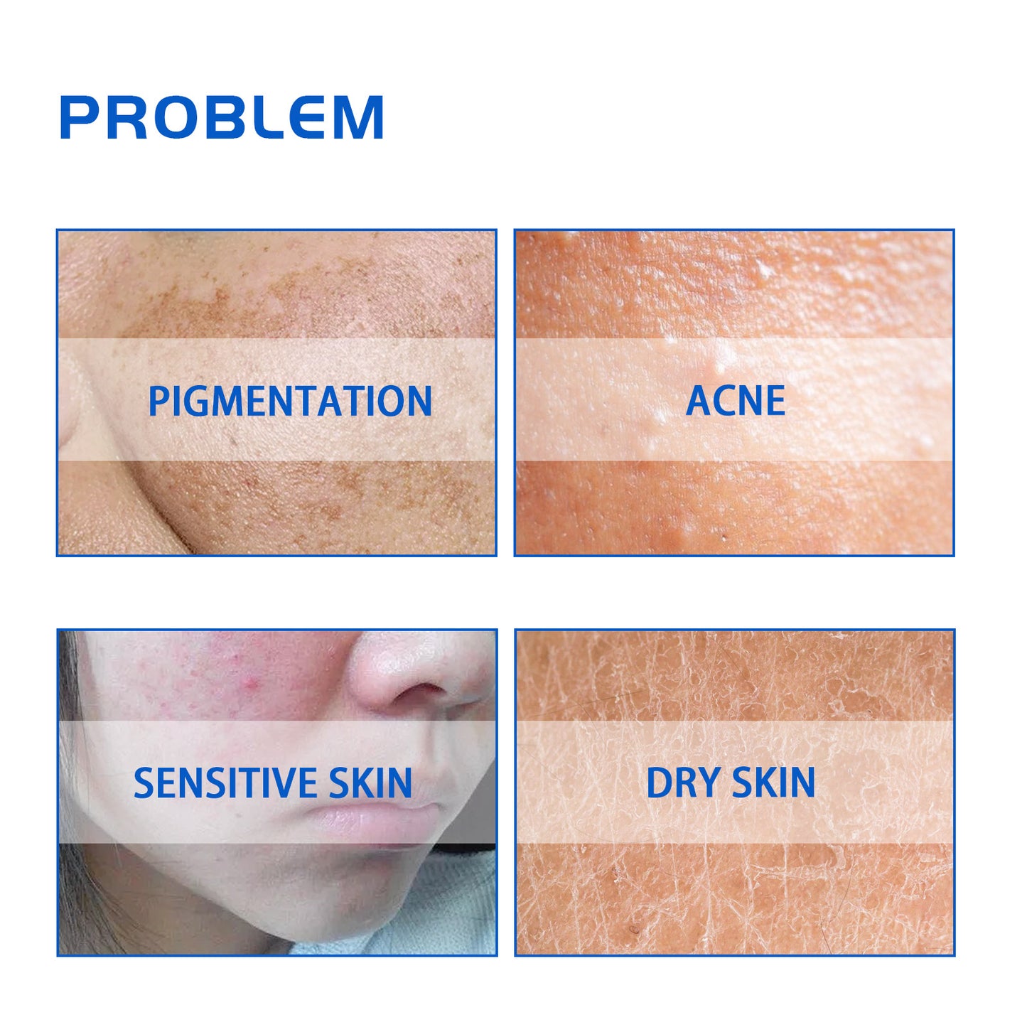 HOYGI Blueberry Facial Care Facial Skin Deep Cleansing Anti-Wrinkle Skin Care Essence Beauty Brightening Cream Health & Beauty Health Eprolo https://www.cyberehub.com