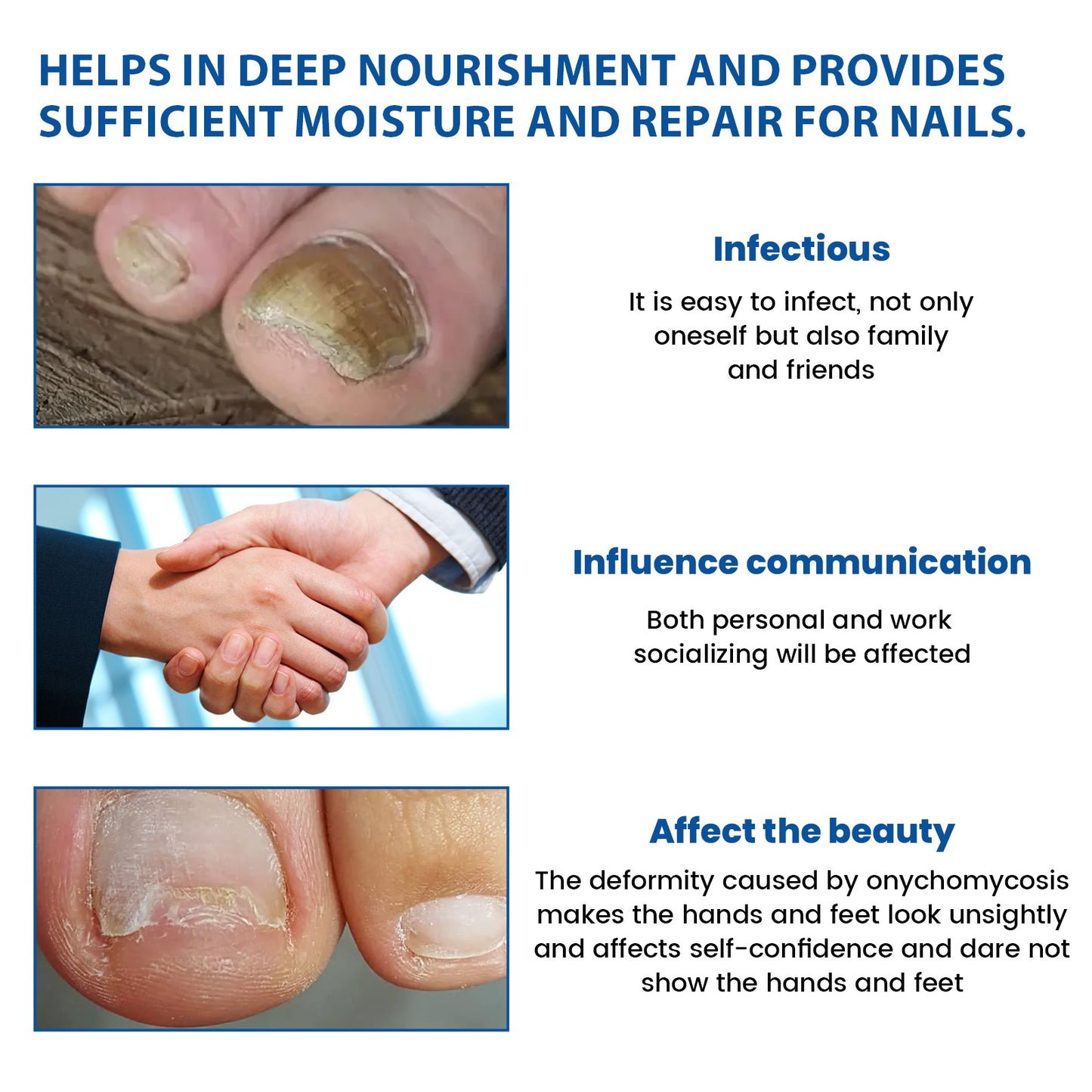 Nighttime Renewal Fungal Nail Patches, Repair And Thickening Gray Nail Insert Soft Nail Care Patch Health & Beauty Health Eprolo https://www.cyberehub.com