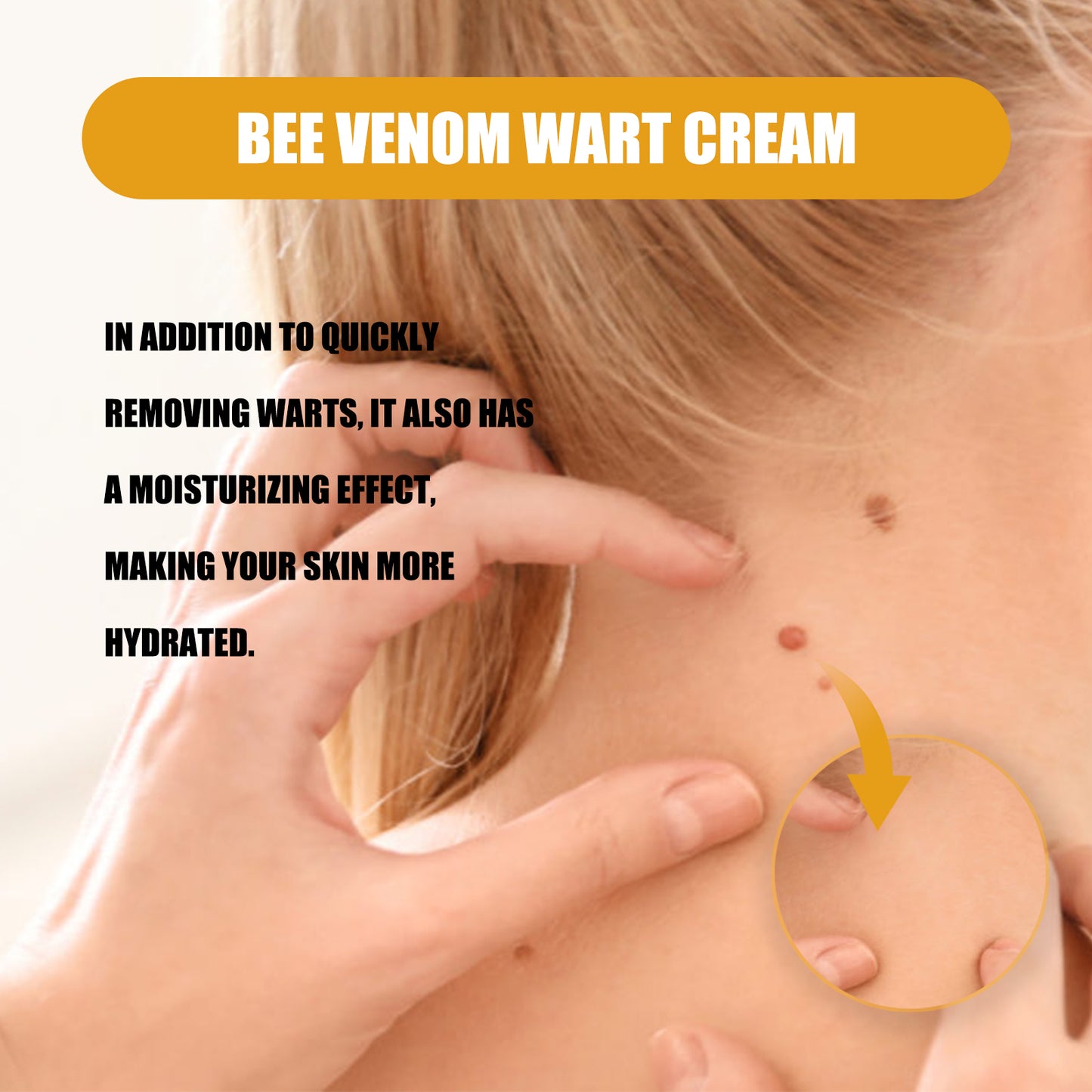 Ximonth Bee Venom Wart Cream, Repair Smooth Skin Lightening Nevus Spot Nevus Cure Wart Care Cream Health Eprolo https://www.cyberehub.com