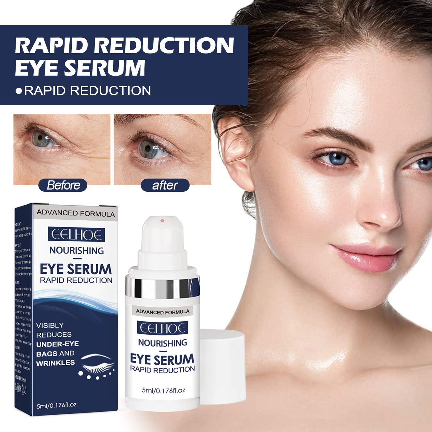 Eye Repair Essence Moisturizes, Hydrates And Lightened Eye Lines, Strengthens, Lifts And Smooths Fine Lines Health Eprolo https://www.cyberehub.com