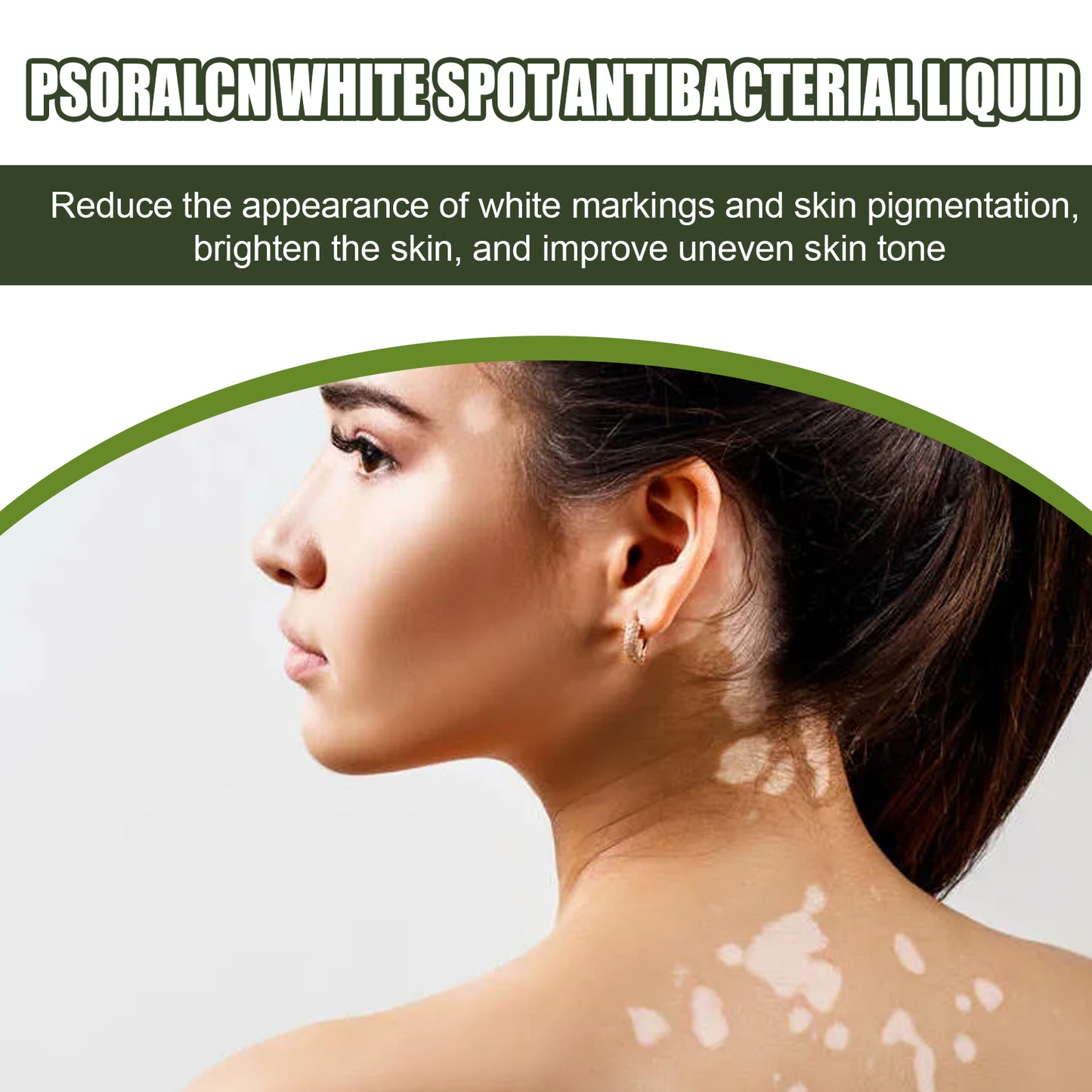 White Spot Purifying Serum For Whitening And Repairing White Spot Spot And Perspiration Spot Skin Moisturizing Serum Health & Beauty Health Eprolo https://www.cyberehub.com