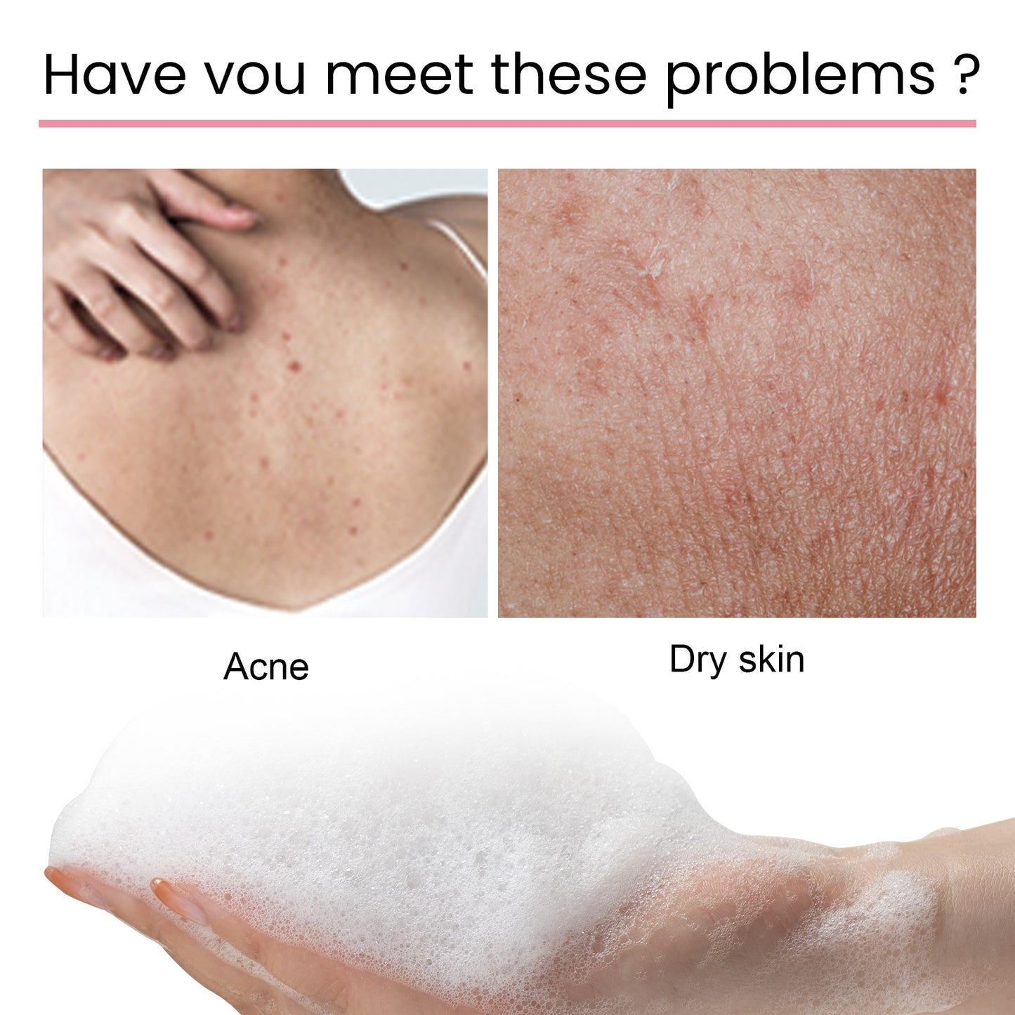 Carbon Clay Back Soap Whitening Body Cleansing Skin Lightening Dark Spots Acne Mark Exfoliating Moisturizing Brightening Soap Health & Beauty Health Eprolo https://www.cyberehub.com