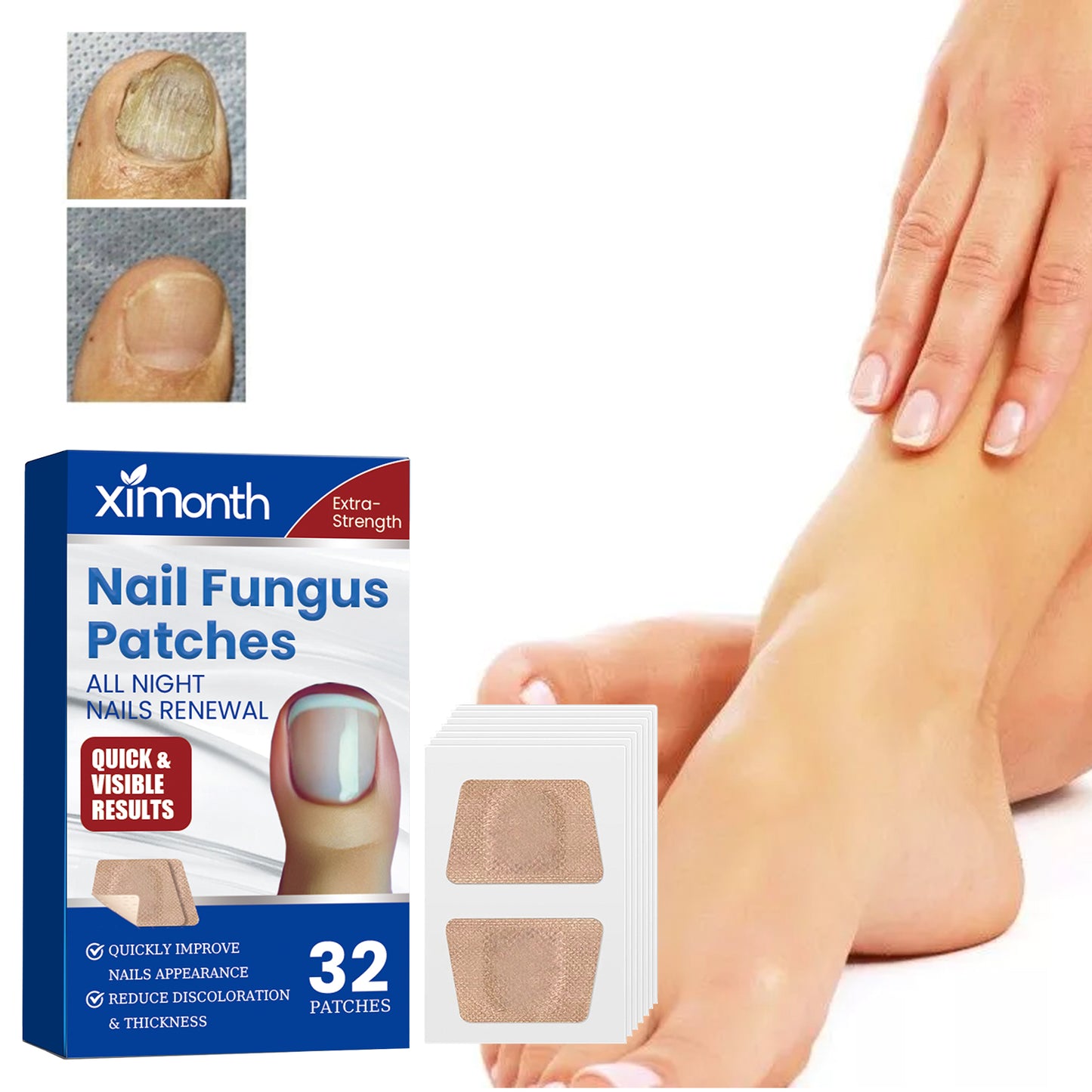 Nail Fungus Patches, Repair Hand And Foot Nails Inlaid Nail Thickening Gray Nail Brightening Nail Patch Health & Beauty Health Eprolo https://www.cyberehub.com