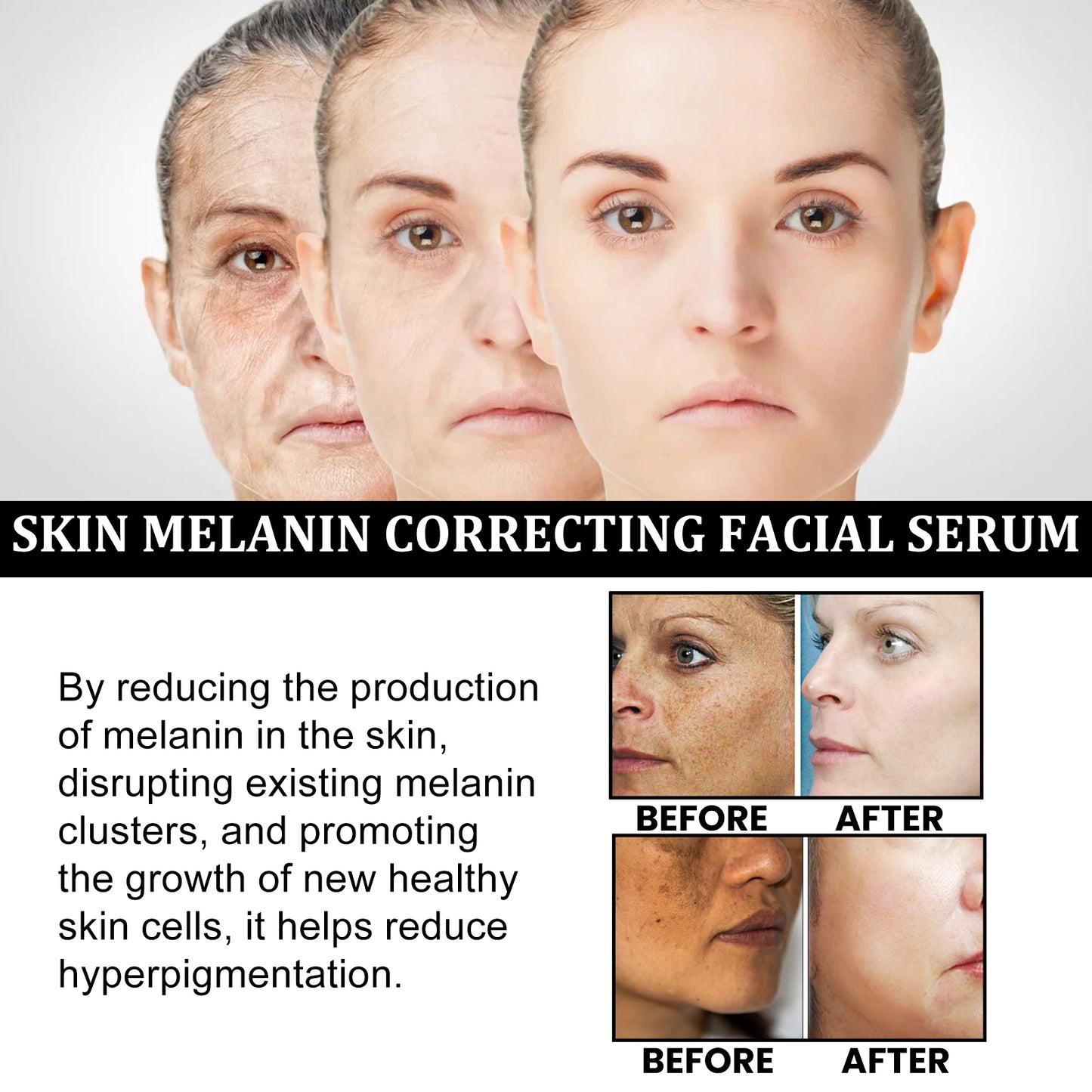 Repair Face Essence Hydrates And Moisturizes Facial Skin To Improve Dull Skin Rejuvenation Essence Health Eprolo https://www.cyberehub.com