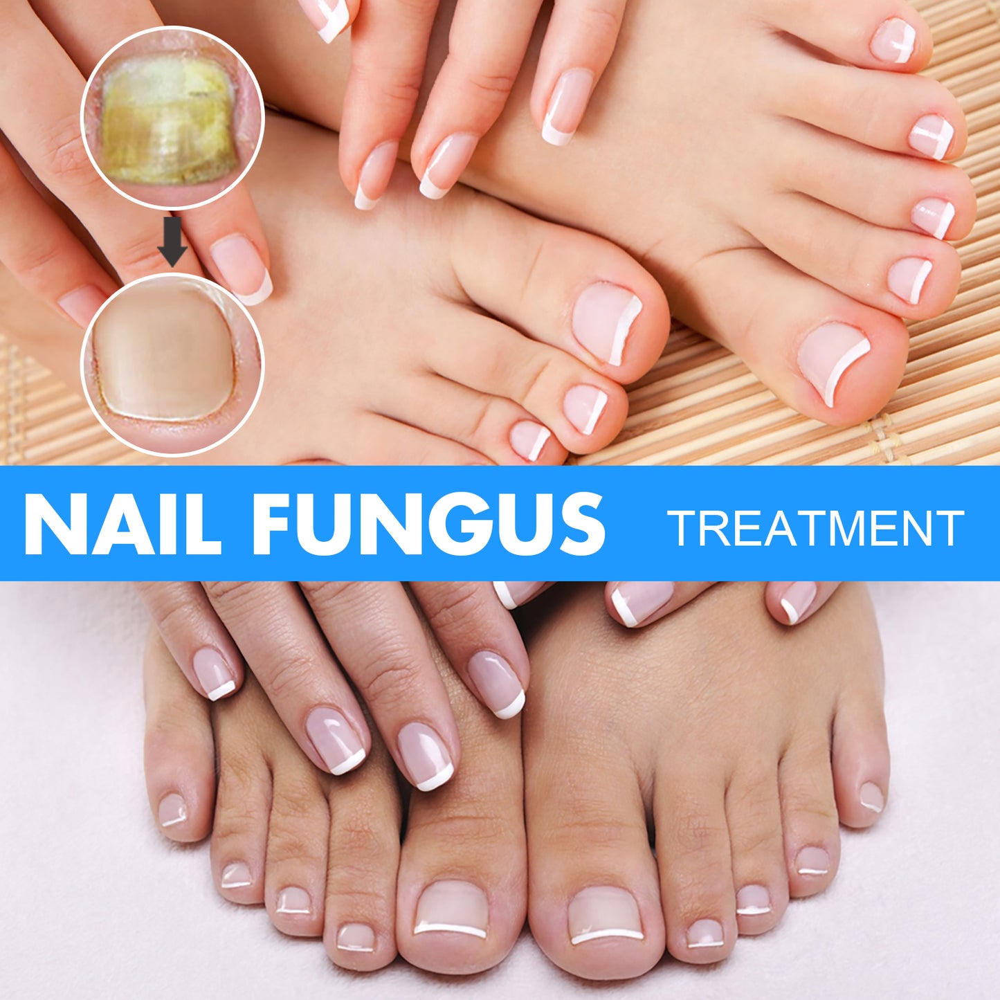 Nail Repair Solution, Hand And Foot Gray Nail Care Repair Gray Nail Solution Thickening Soft Nails Health Eprolo https://www.cyberehub.com