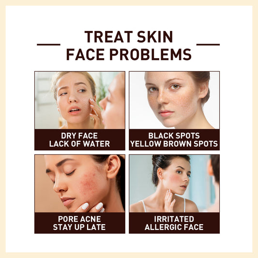 Rice Anti Wrinkle Essence, Repairs Skin Moisturizes Firms Whitens Essence Health Eprolo https://www.cyberehub.com