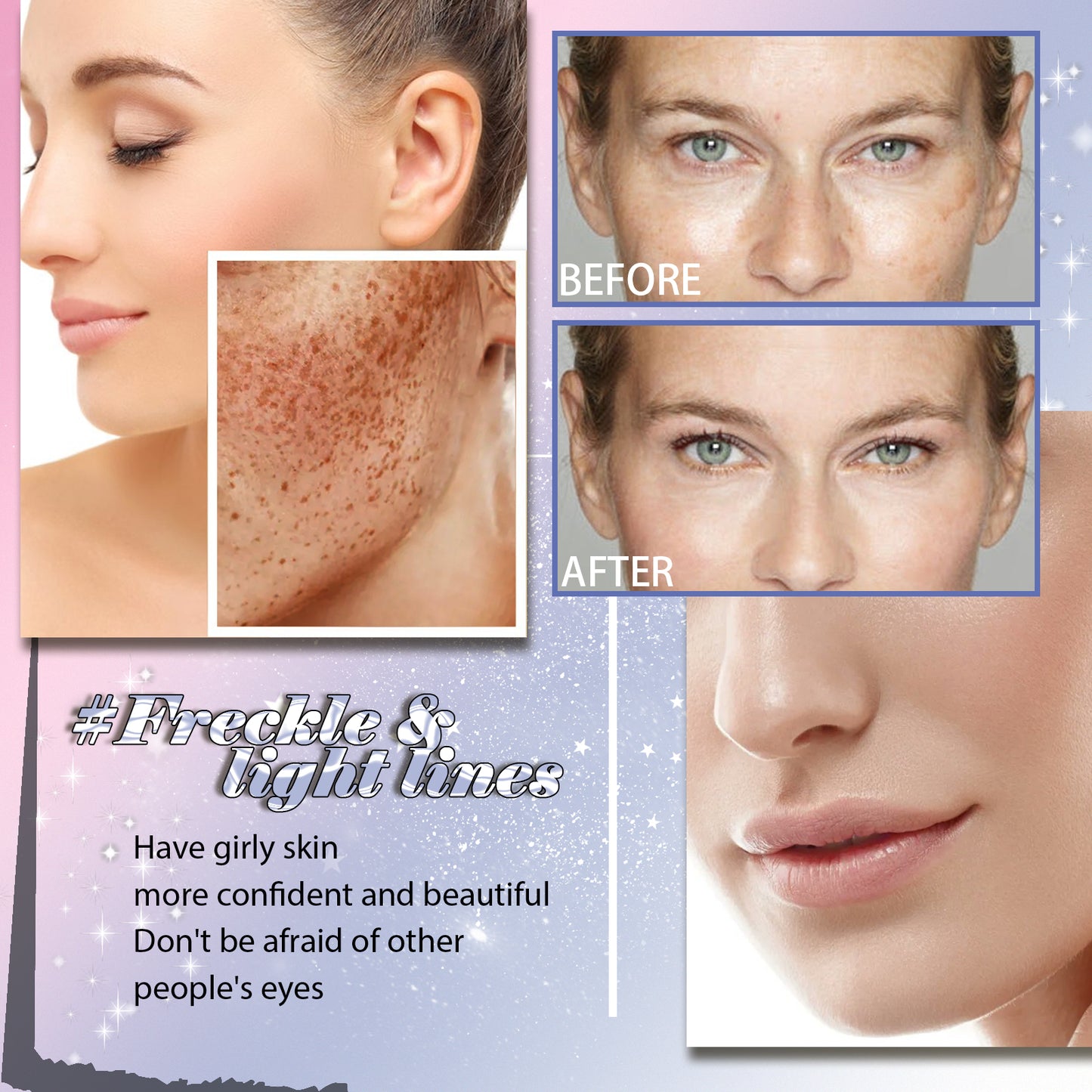 Freckle Removing Anti-aging Essence, Facial Firming Anti-wrinkle Lightening Melasma Stain Nourishing Skin Essence Health Eprolo https://www.cyberehub.com