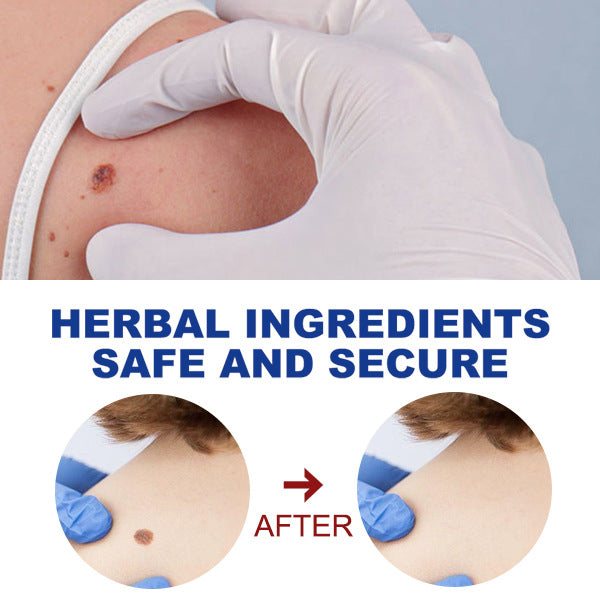 Kayu Liquid Pen Gently Cleanses Skin Care Body Face Label Meat Pellet Kayu Liquid Health Eprolo https://www.cyberehub.com