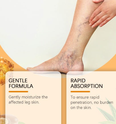 Leg Care Spray For Daily Relief Of Leg Varicosity Health & Beauty Health & Beauty Under 10 UniversalMaax https://www.cyberehub.com