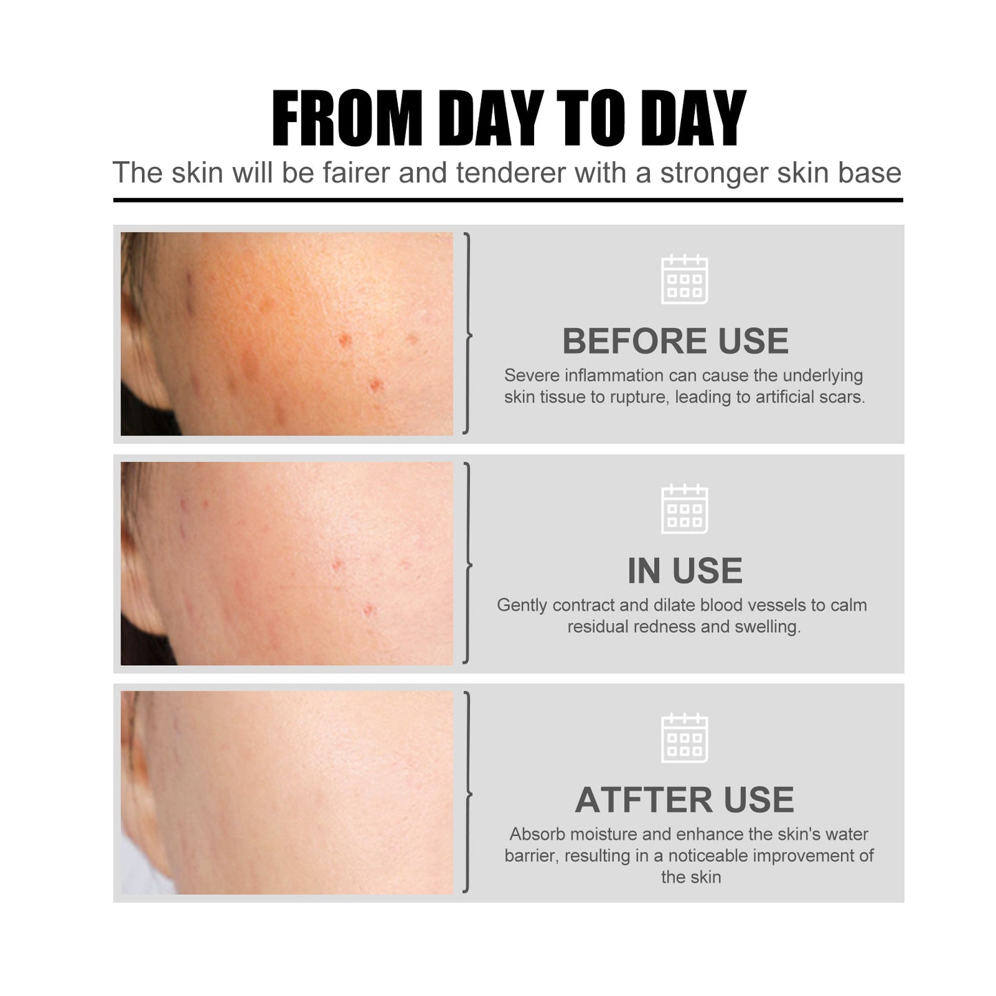 Nicotinic Acid Face Essence Lighten Acne Marks, Moisturize Pores, Shrink And Whiten Skin Beauty Essence Health Eprolo https://www.cyberehub.com