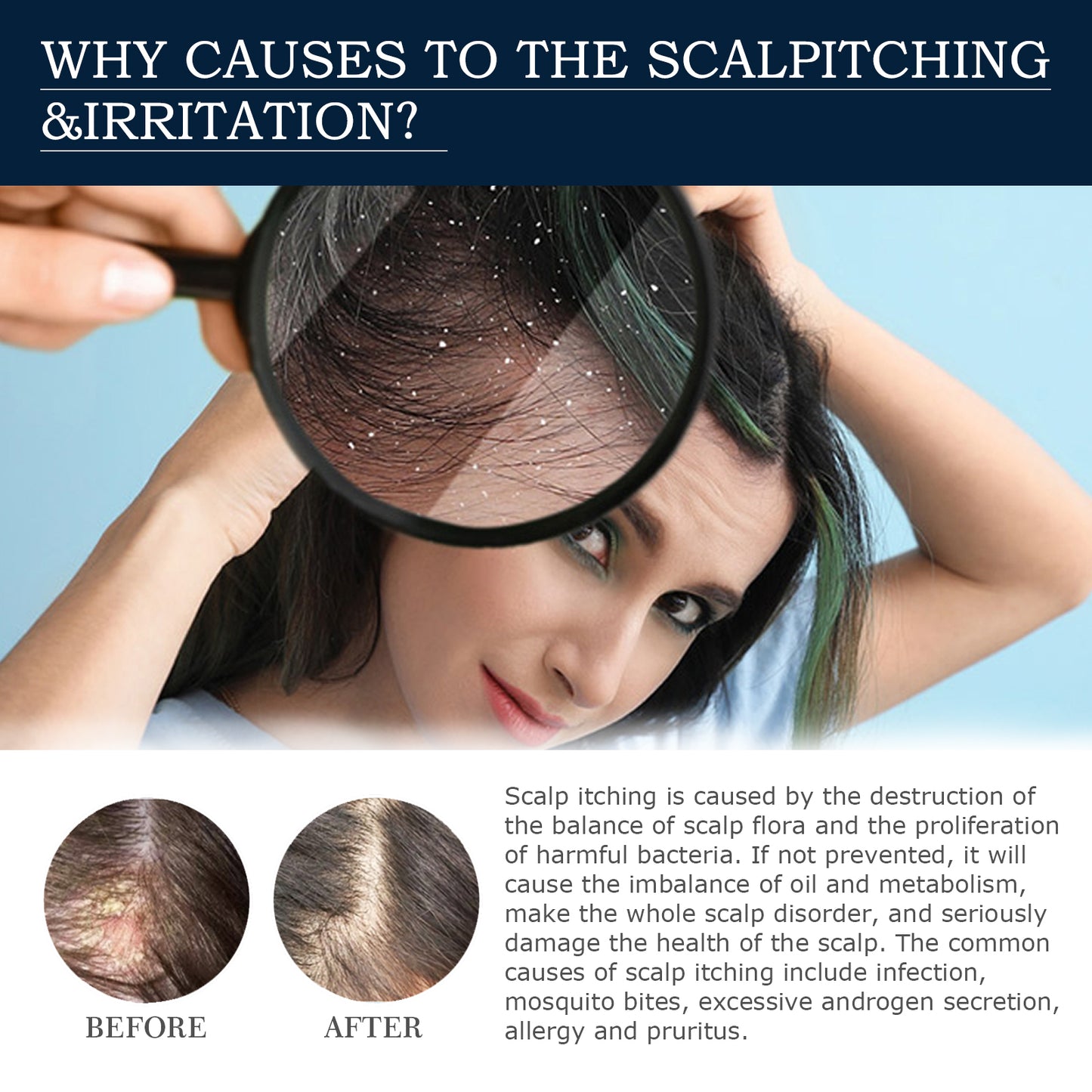 Scalp Treatment Essence Spray, Hair Care And Repair Damaged Hair Follicle Hair Root Treatment Spray Health Eprolo https://www.cyberehub.com