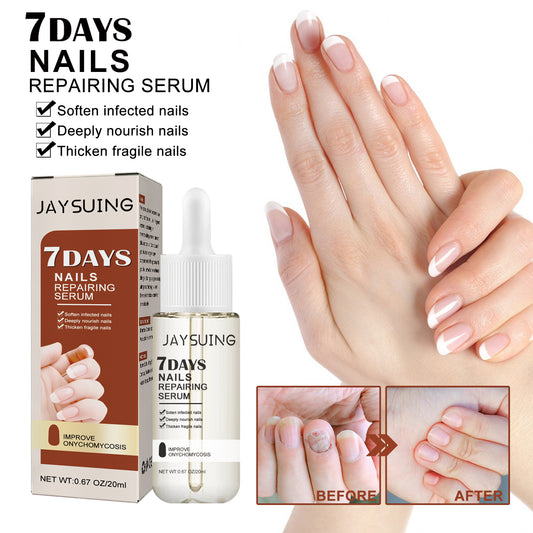 Jaysuing 7 Day Nail Care Essence Grey Nail, Hand, Foot And Nail Nourishing Cleansing Essence Health Eprolo https://www.cyberehub.com