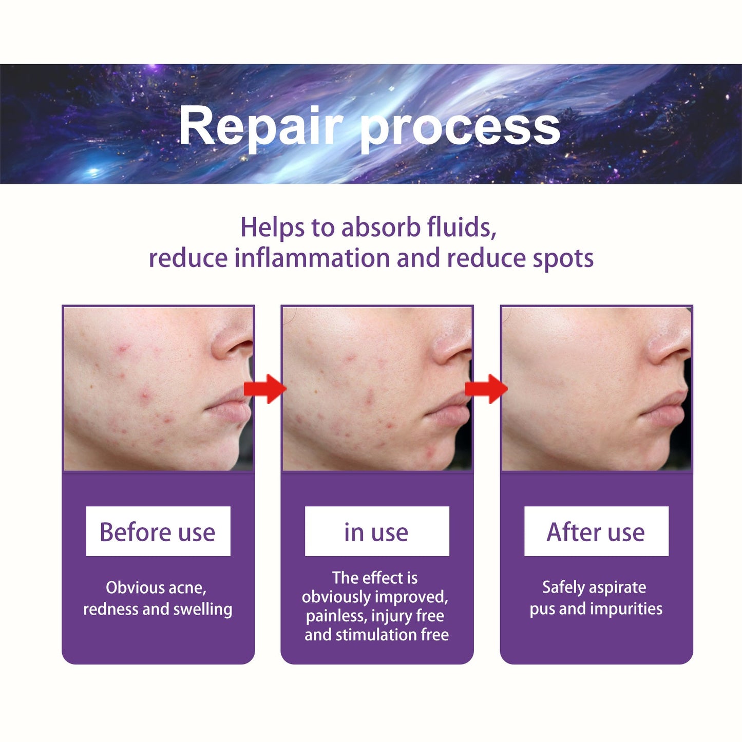 Breathable Repair Acne Skin Pattern Acne Patch Health & Beauty Health & Beauty Under 10 UniversalMaax https://www.cyberehub.com