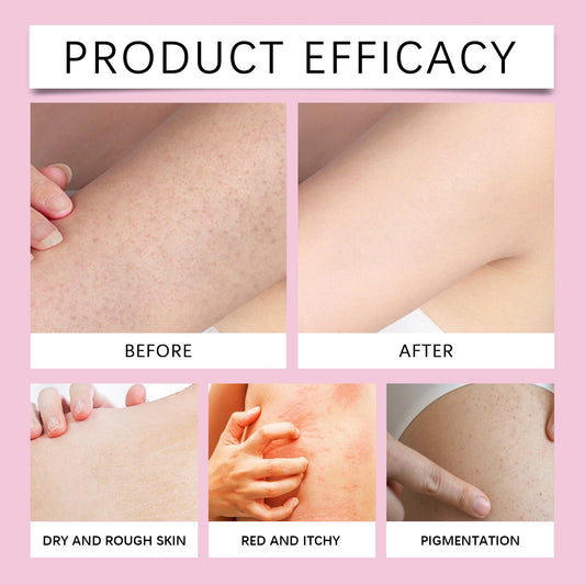 Moisturizing Moisturizing Cream For Delicate And Smooth Skin Health & Beauty Health & Beauty Under 10 UniversalMaax https://www.cyberehub.com