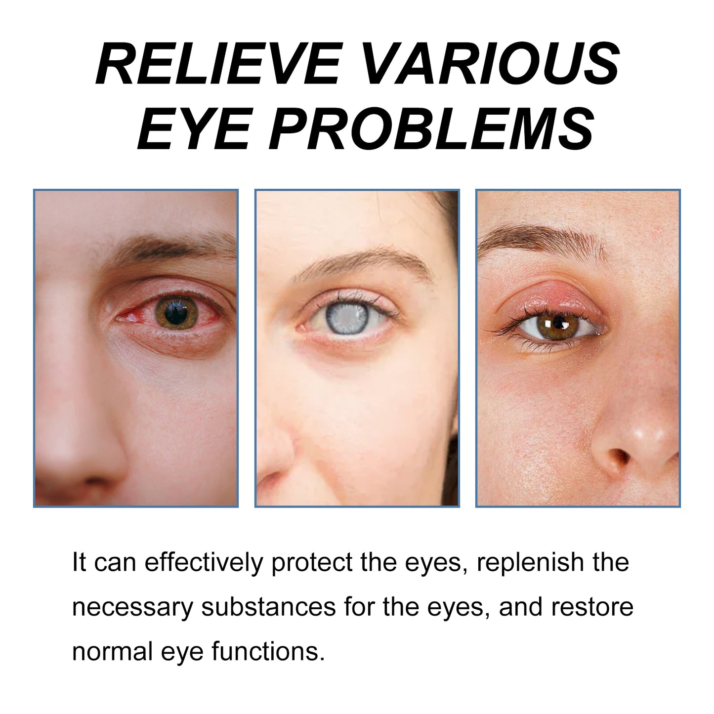 Myopic Eye Drops For Eye Fatigue, Swelling, Swelling, Blurred Vision Mild Eye Drops Health Eprolo https://www.cyberehub.com