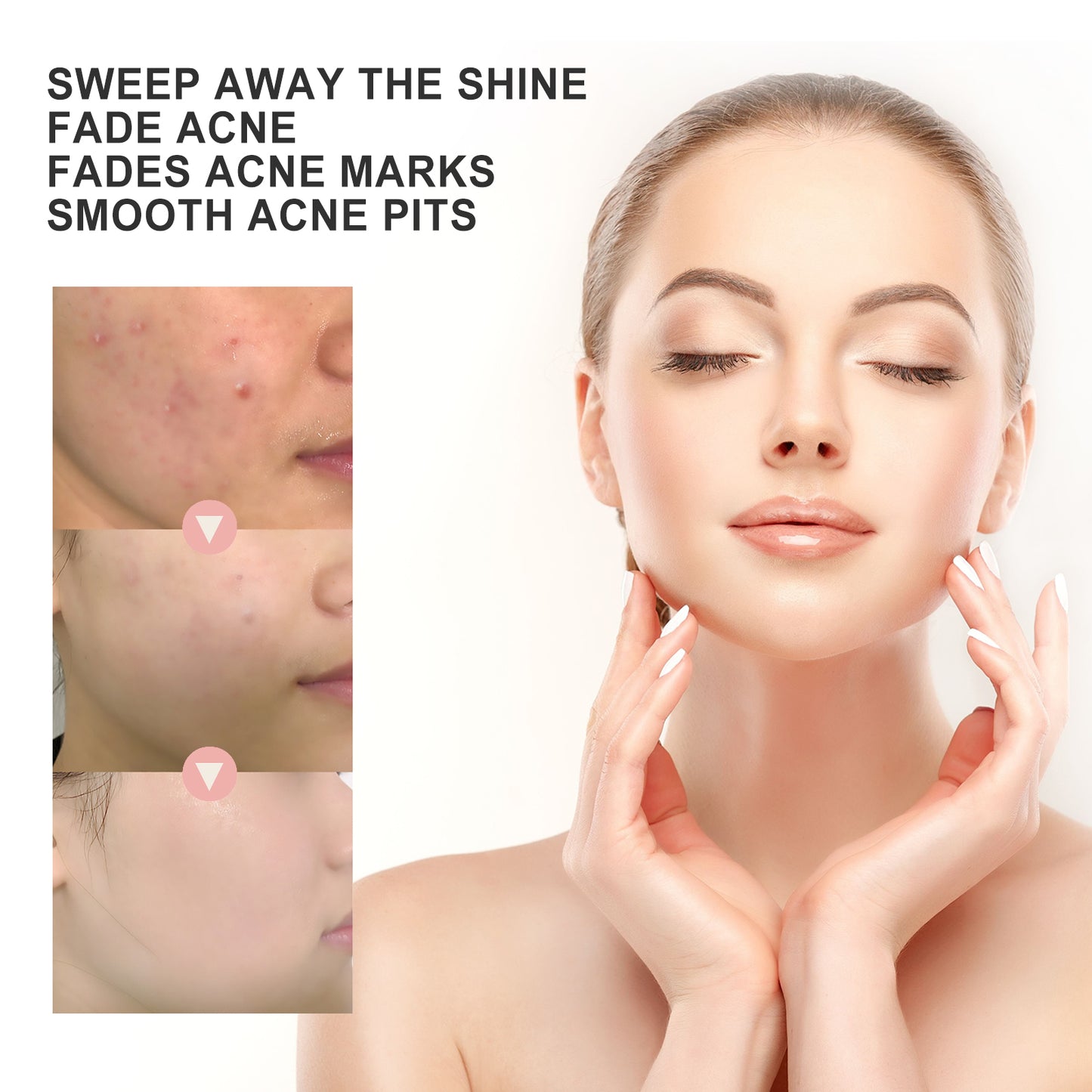Acne Patch, Repair Acne Pimple Facial Redness Clean Pores Moisturize Skin Patch Health Eprolo https://www.cyberehub.com