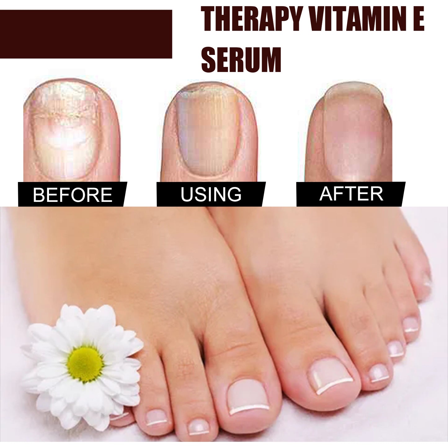 Therapy Vitamin E Serum, Hand And Foot Nail Repair Bright Nail Grey Nail Soft Nail Embedded Nail Care Essence Health Eprolo https://www.cyberehub.com