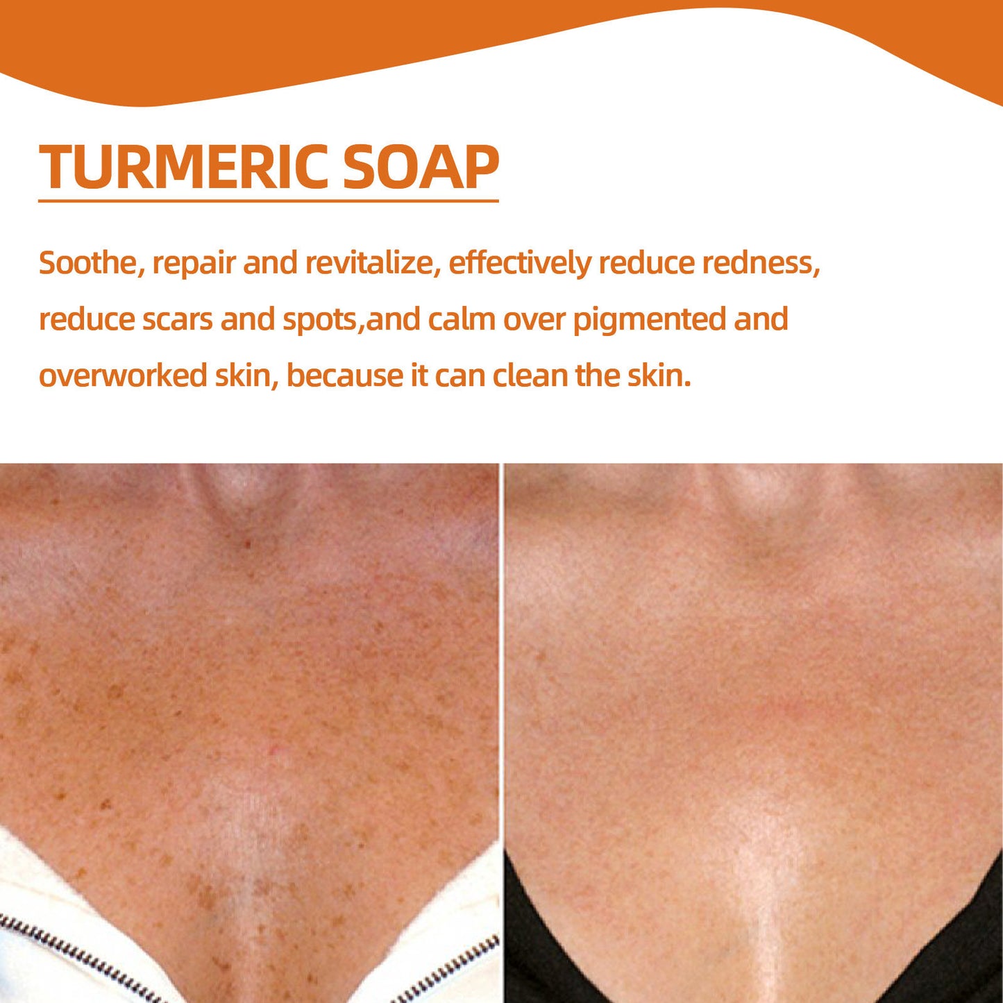 Turmeric Soap, Refreshing Tender Skin Lightening Dark Spot Acne Print Smooth Skin Body Cleansing Soap Health Eprolo https://www.cyberehub.com