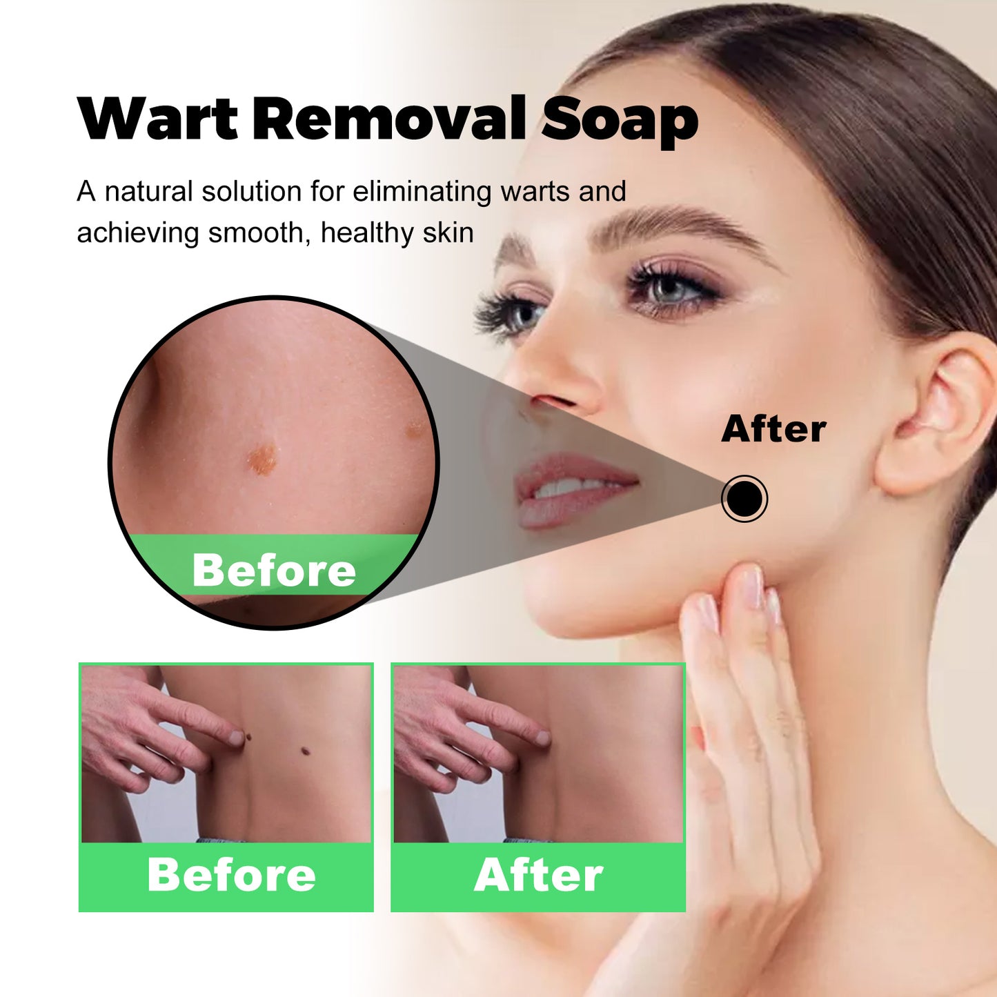Skin Tag Removal Rubber Band, Remove Moles Remove Warts Face Neck Flesh Granule Body Cleansing Soap Health Eprolo https://www.cyberehub.com