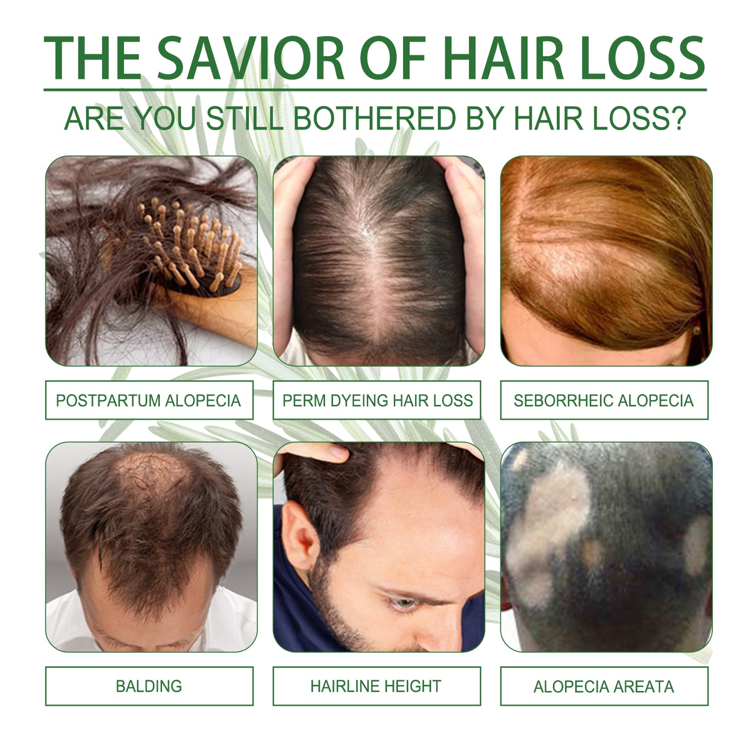 Rosemary Hair Dense Essential Oil, Prevent Hair Breakage And Hair Loss Strong, Strong And Solid Hair Moisturizing Root Dense Essential Oil Health Eprolo https://www.cyberehub.com