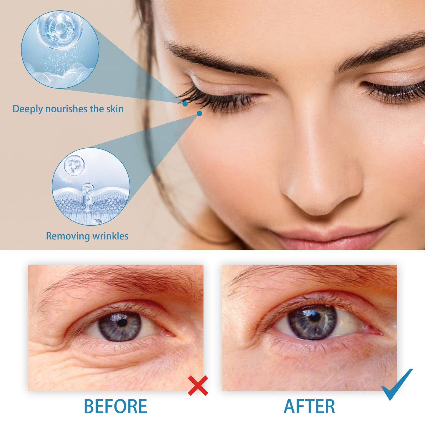 Retinol Eye Cream For Wrinkles Reduces Fine Lines, Dark Circles And Bags Under Eyes Health Eprolo https://www.cyberehub.com