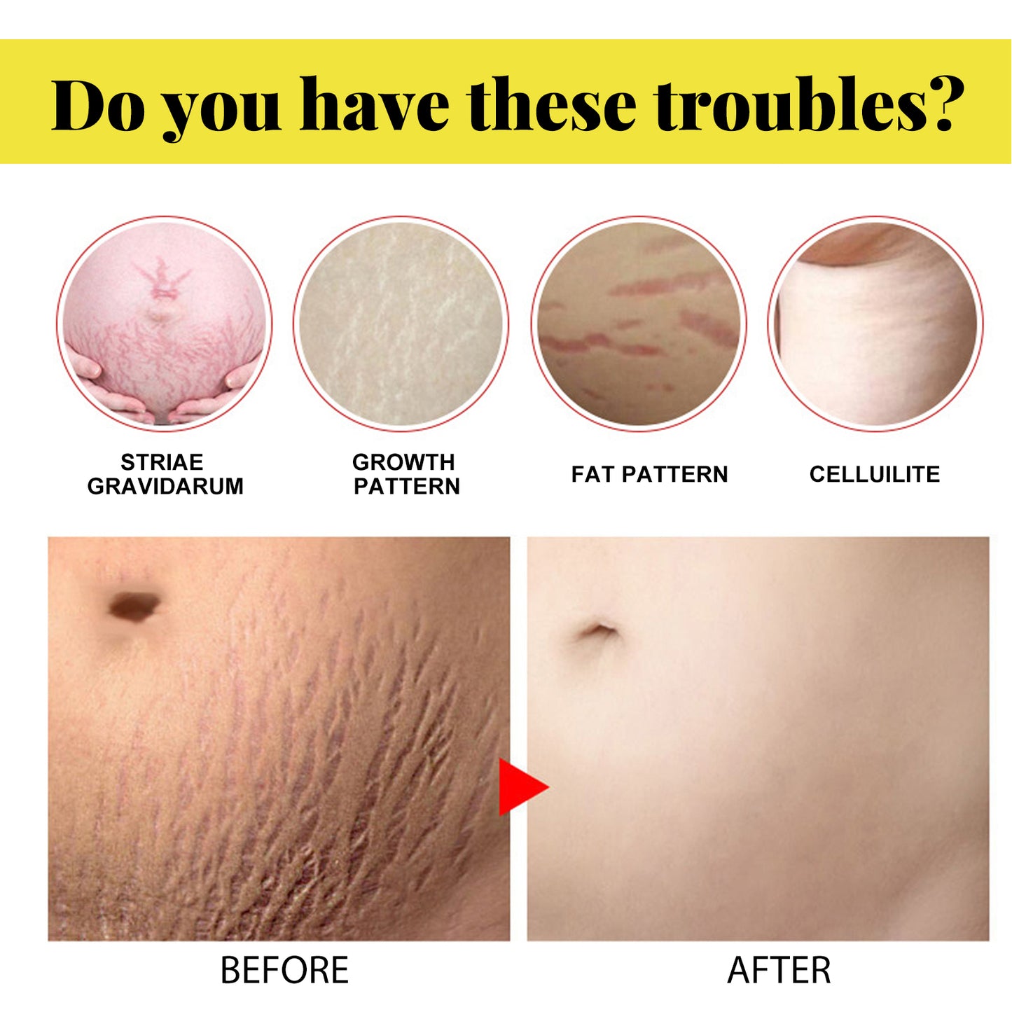 Skin Care Cream, Pregnant Women's Body Skin Gentle Repair Daily Care Moisturizing Moisturizer Health Eprolo https://www.cyberehub.com