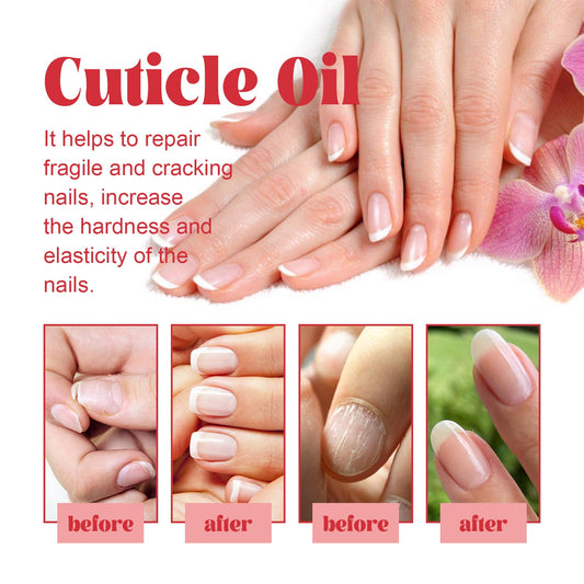 Repairing Hand, Foot And Nail Thickening Care Liquid Health & Beauty Health & Beauty Under 10 UniversalMaax https://www.cyberehub.com