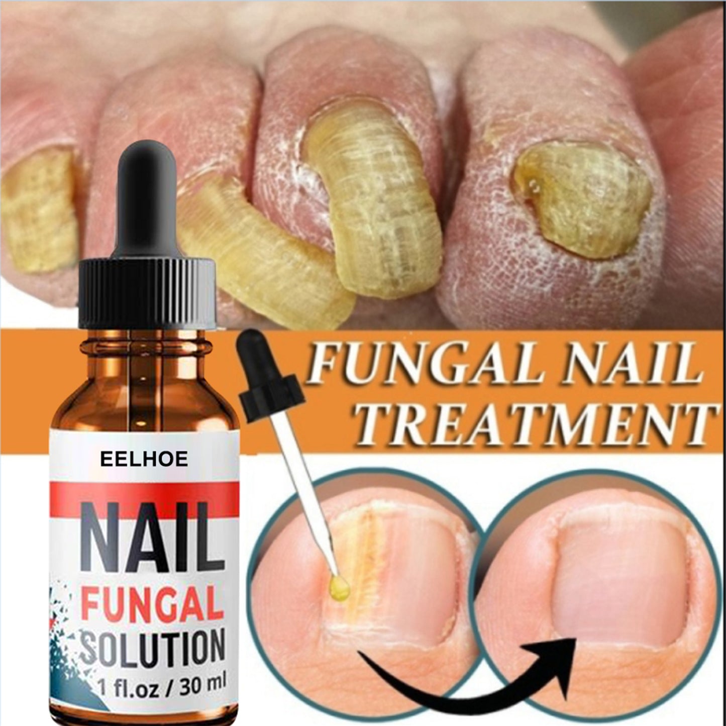 Nail Repair Solution, Hand And Foot Gray Nail Care Repair Gray Nail Solution Thickening Soft Nails Health Eprolo https://www.cyberehub.com