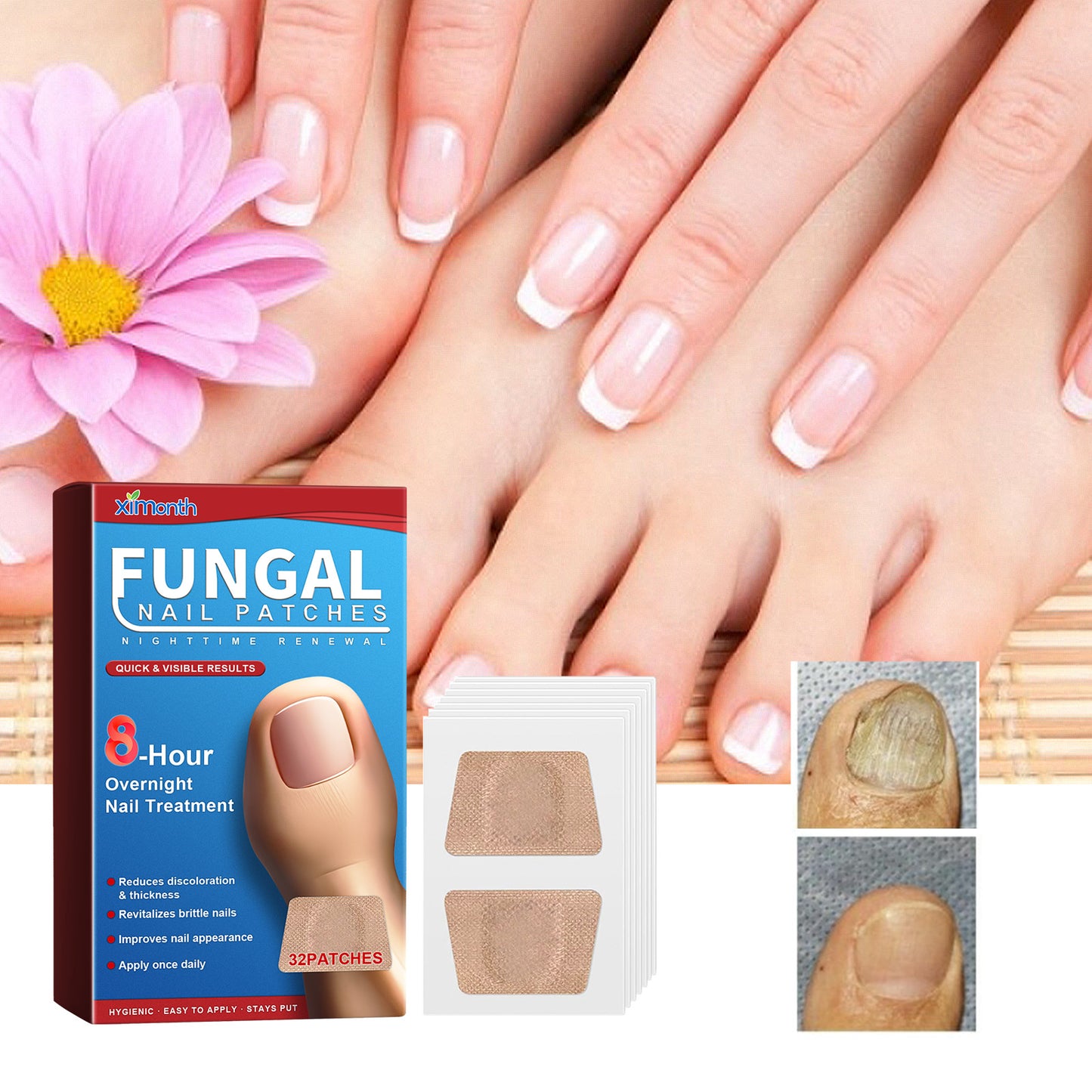 Nighttime Renewal Fungal Nail Patches, Repair And Thickening Gray Nail Insert Soft Nail Care Patch Health & Beauty Health Eprolo https://www.cyberehub.com