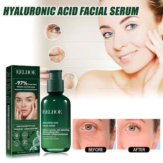 EELHOE Facial Essence, Lifts And Tightens Facial Skin And Reduces Fine Lines And Wrinkles Health Eprolo https://www.cyberehub.com