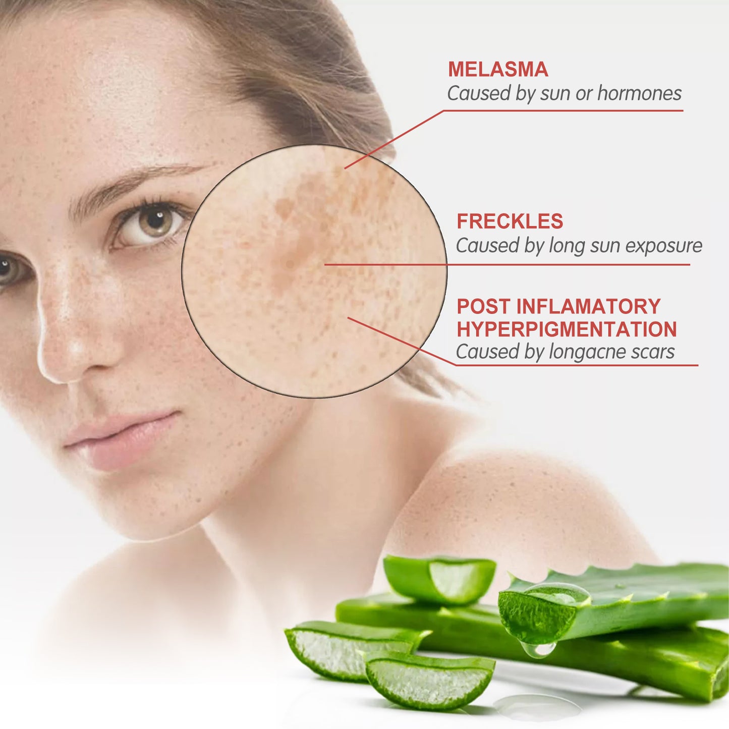 Speckle Corrector Cream, Lighten Spots And Wrinkles Repair Dull Skin Hydrating Brightening Cream Health Eprolo https://www.cyberehub.com