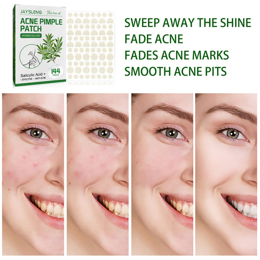 Waterproof Invisible Acne Patch Lighten Acne Acne Print Moisturizing Repair Clear Patch Health Eprolo https://www.cyberehub.com