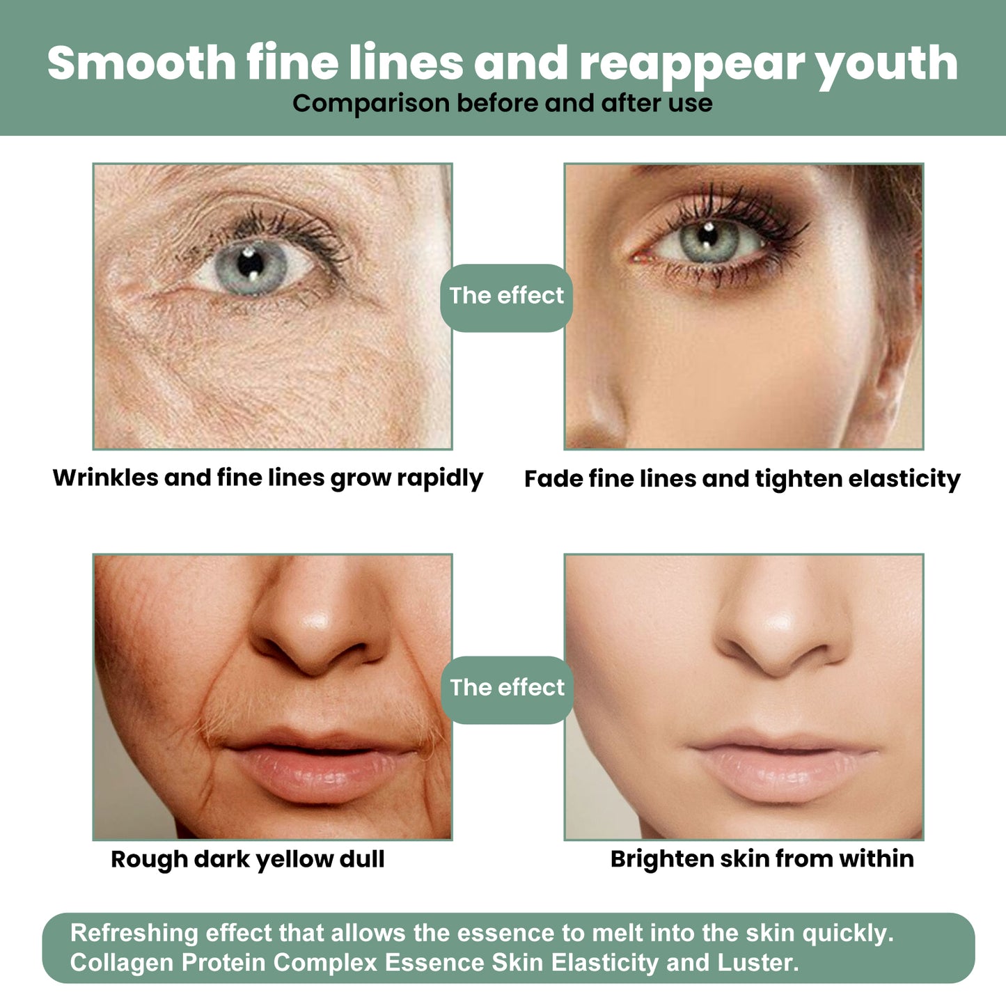 Collagen Anti-Aging Serum, Hydrates Reduces Fine Lines And Firming Skin Care Essence Health Eprolo https://www.cyberehub.com