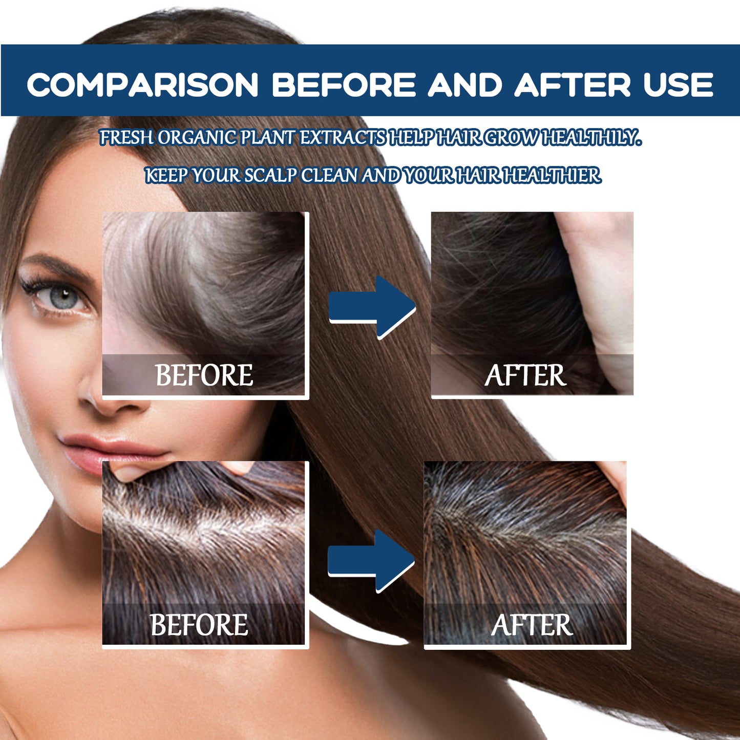 EAST MOON Hair Treatment Spray Moisturizes And Softens Hair, Prevents Loose Hair And Thickens Hair Treatment Spray Health Eprolo https://www.cyberehub.com