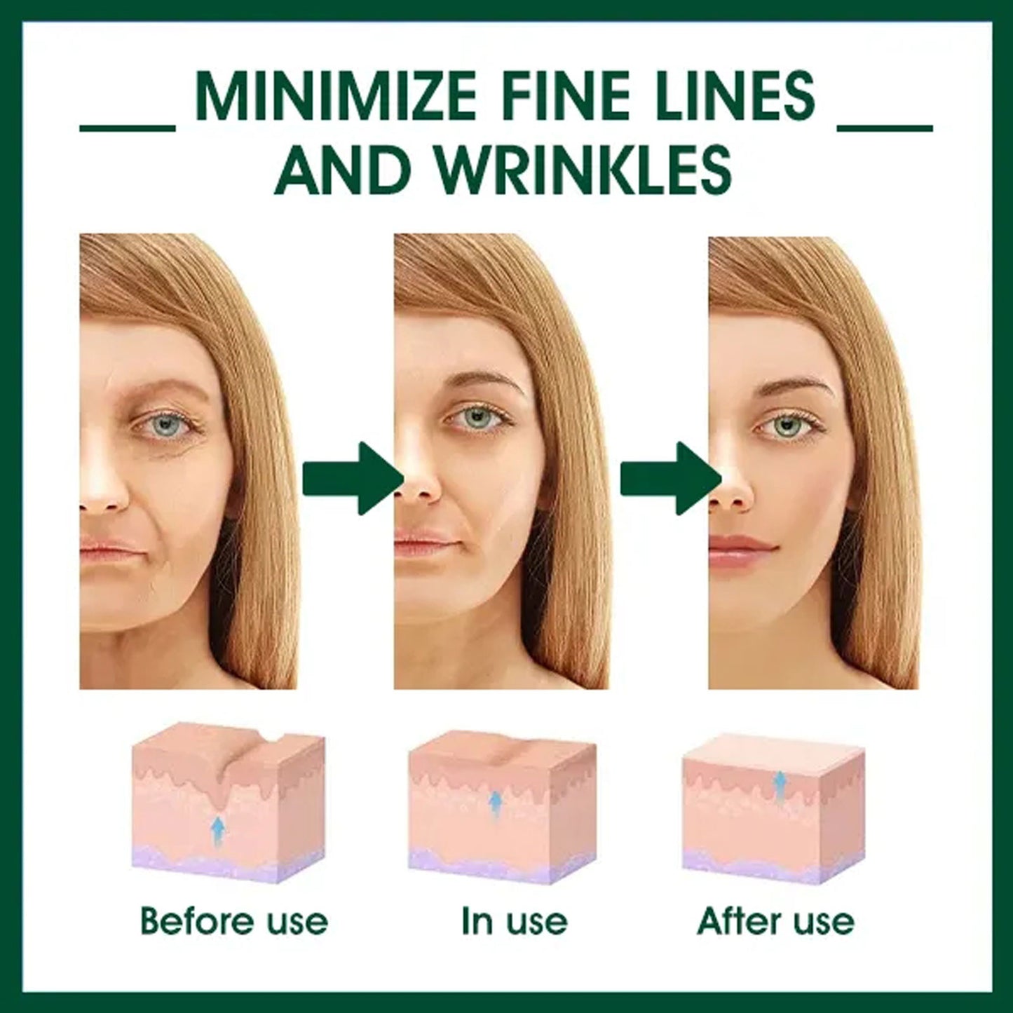 EELHOE Facial Essence, Lifts And Tightens Facial Skin And Reduces Fine Lines And Wrinkles Health Eprolo https://www.cyberehub.com