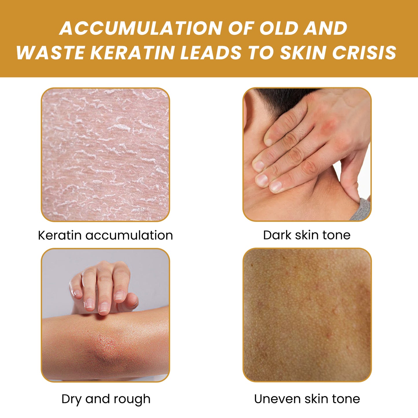 Turmeric Sugar Body Scrub, Fade Acne Mark Moisturizing Refreshing Smooth Tender Skin Cleansing Body Exfoliating Scrub Health Eprolo https://www.cyberehub.com