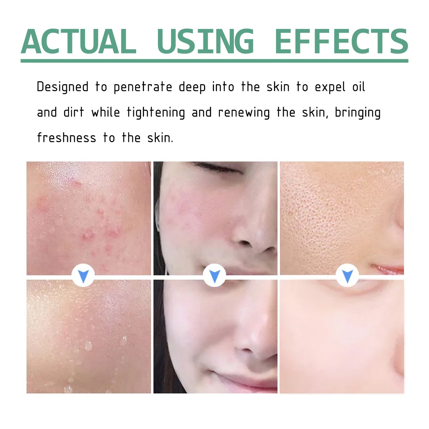 Green Tea Cleansing Mud Mask, Facial Cleansing Moisturizing Whitening Skin Blackhead Acne Removing Mud Mask Health & Beauty Health Eprolo https://www.cyberehub.com