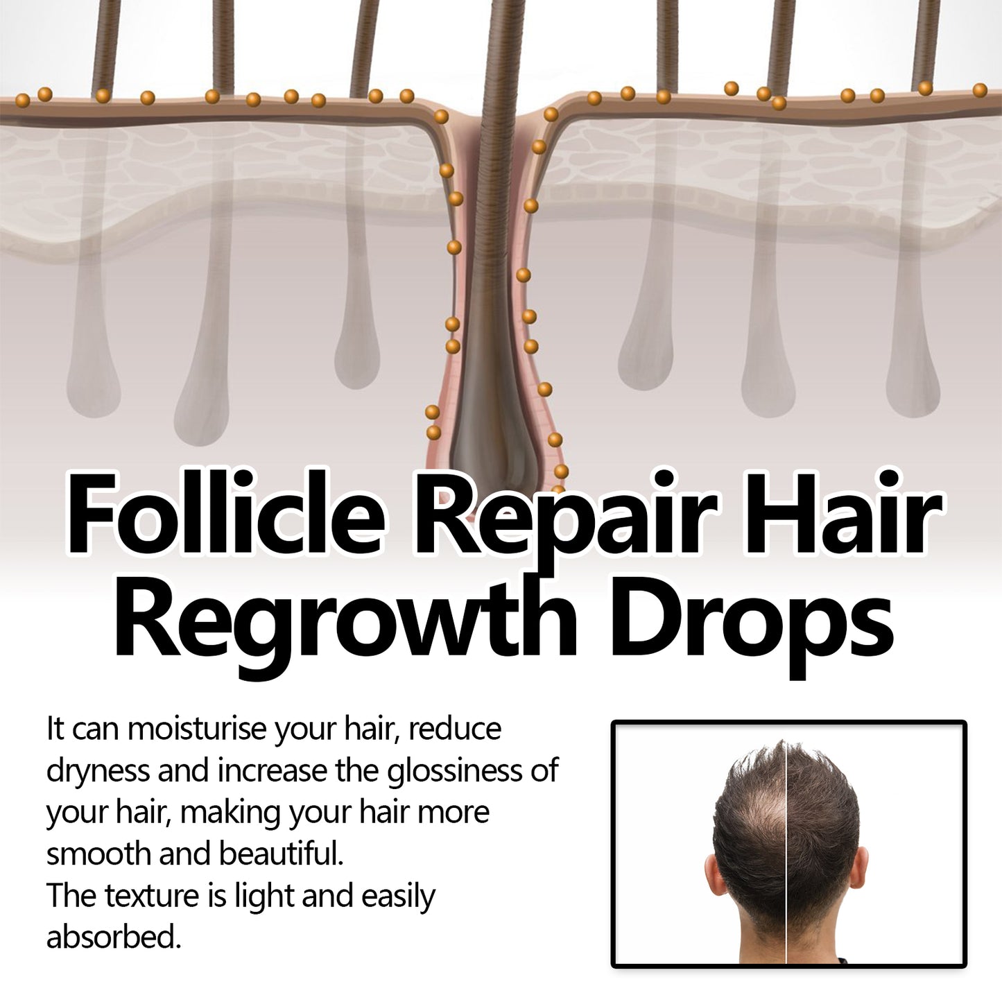Follicle Repair Hair Regrowth Drops, Hair Protection Strong And Solid Hair Thickening Scalp Nourishing Massage Lotion Health Eprolo https://www.cyberehub.com