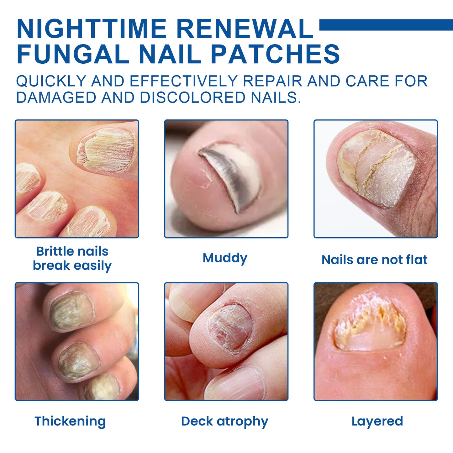 Nighttime Renewal Fungal Nail Patches, Repair And Thickening Gray Nail Insert Soft Nail Care Patch Health & Beauty Health Eprolo https://www.cyberehub.com
