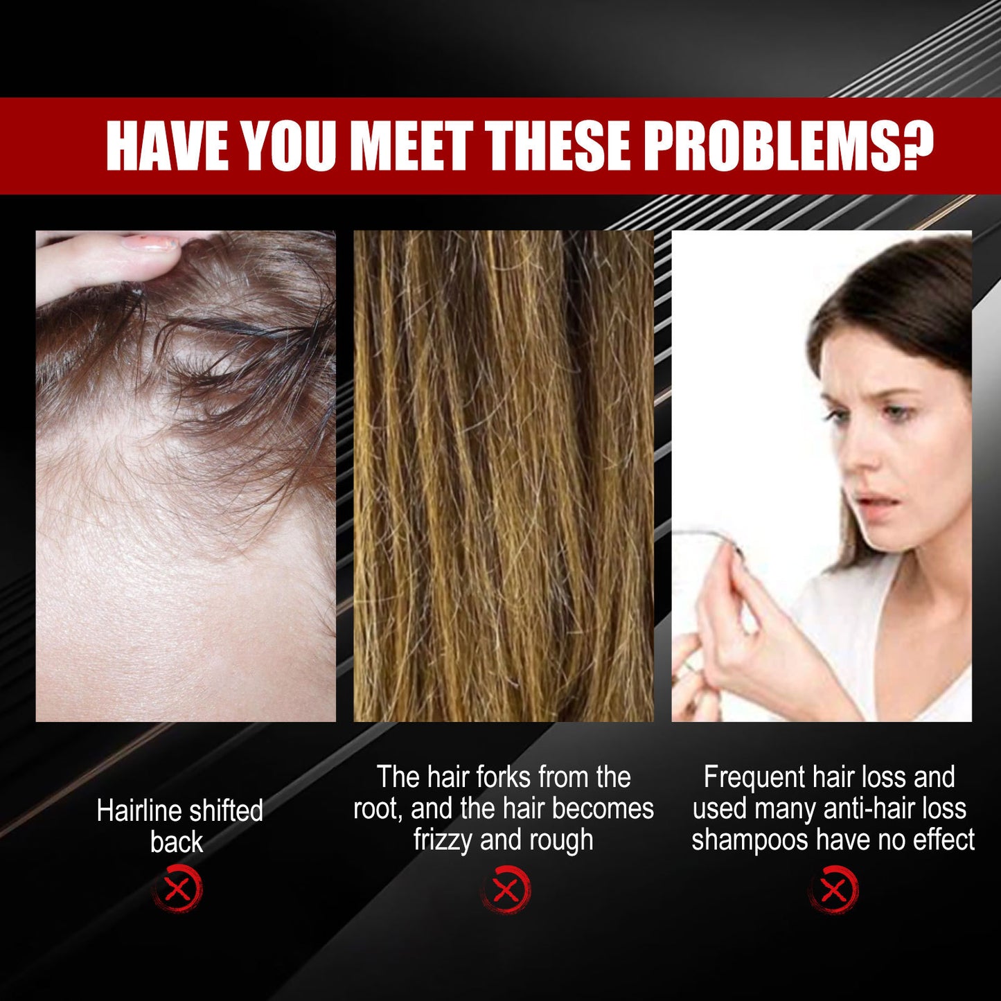 Black Rice Hair Spray Strengthen And Strengthen Hair Dense Hair Hydrating Repair Root Soft Hair Growth Spray Health & Beauty Health Eprolo https://www.cyberehub.com