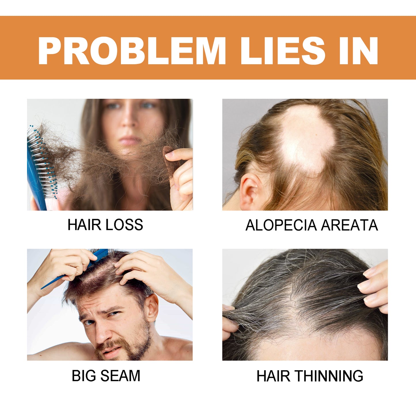 Mypa Ampoule, Strengthen And Repair Hair, Prevent Hair Loss, Strengthen Hair Root And Thicken Hair And Scalp Massage Solution Health Eprolo https://www.cyberehub.com