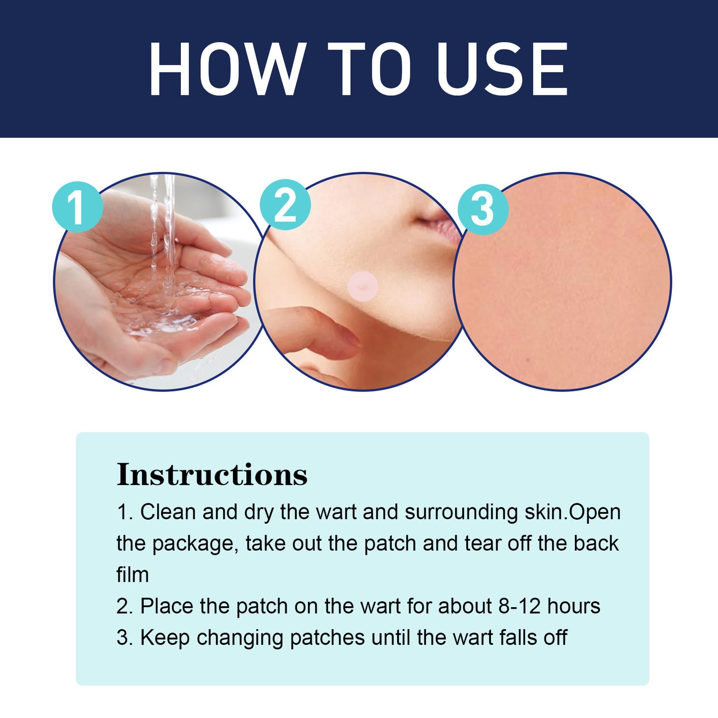 Kwart Patch, Clean And Fade Skin Moles Moles Corns Filamentary Warts Body Skin Care Flat Wart Patch Health Eprolo https://www.cyberehub.com